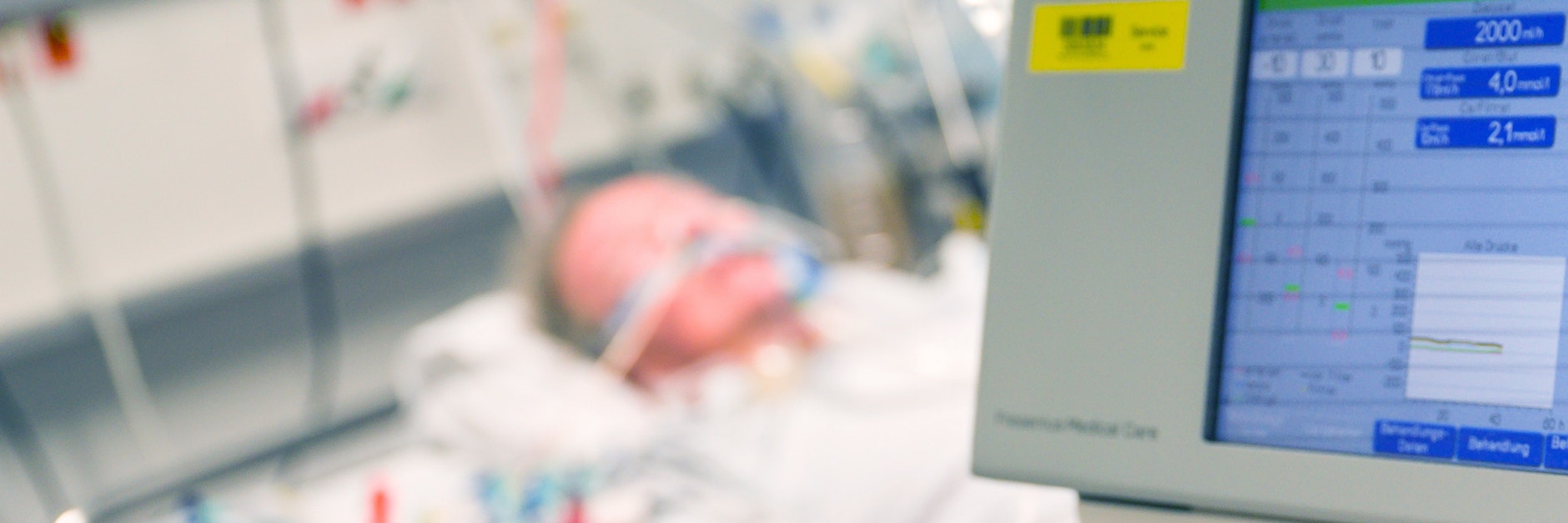 Ein Patient liegt auf einem Intensivzimmer und wird beatmet. Bei einem Patienten in Frankreich trat neben den üblichen Symptomen auch eine Dauererektion auf.