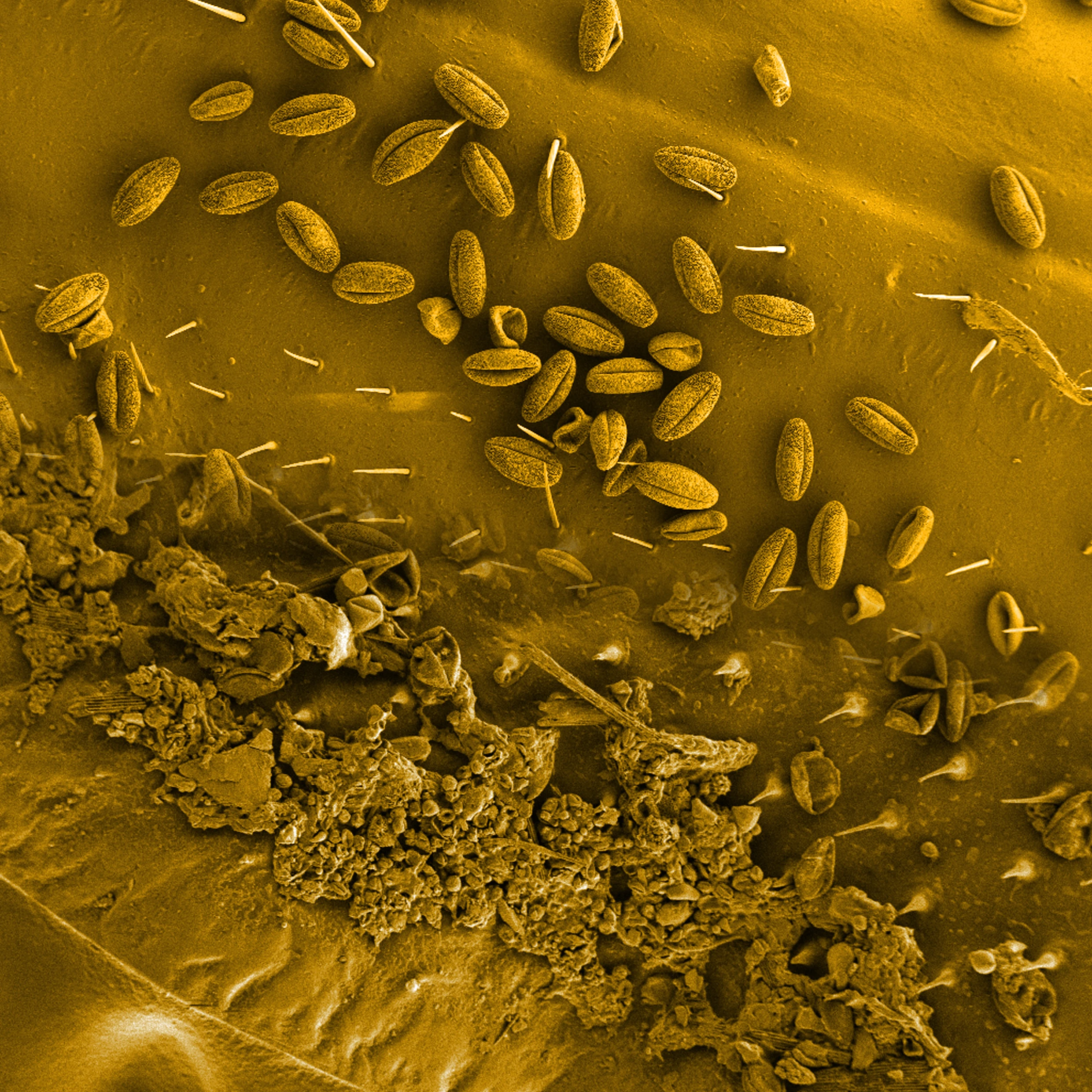 Bienenflügel unter dem Mikroskop: Der obere Teil der Aufnahme zeigt den Flügelteil einer Biene, die in relativ sauberer Umgebung im indischen Bangalore auf Nahrungssuche war. Die länglichen Gebilde sind Pollen. Die untere Bildhälfte zeigt den Flügelteil einer Biene, die in verschmutzter Luft unterwegs war. Auf ihrem Flügel haben sich viele kleine Staubpartikel abgelagert.&nbsp;