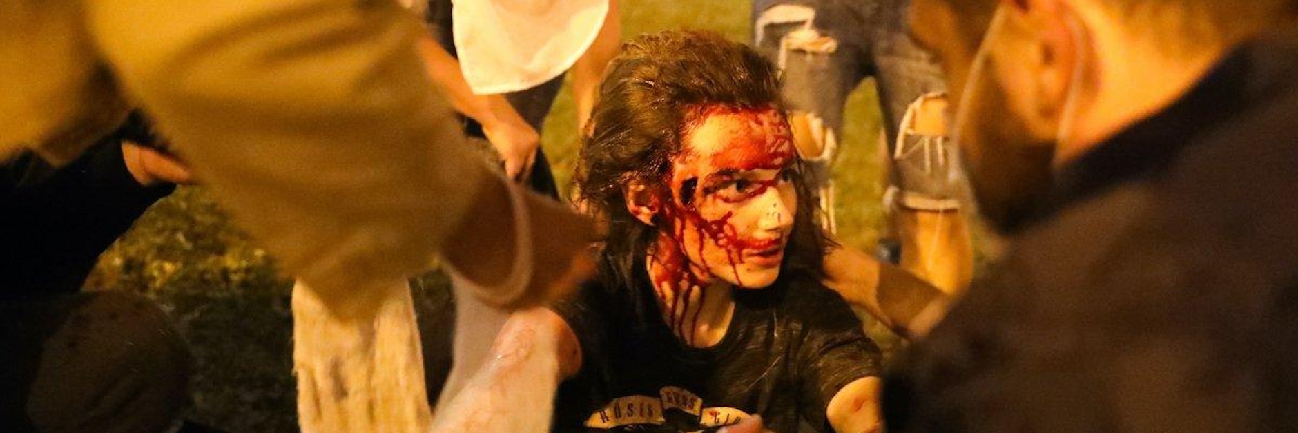 Ein Gummigeschoss traf diese junge Frau am Kopf.