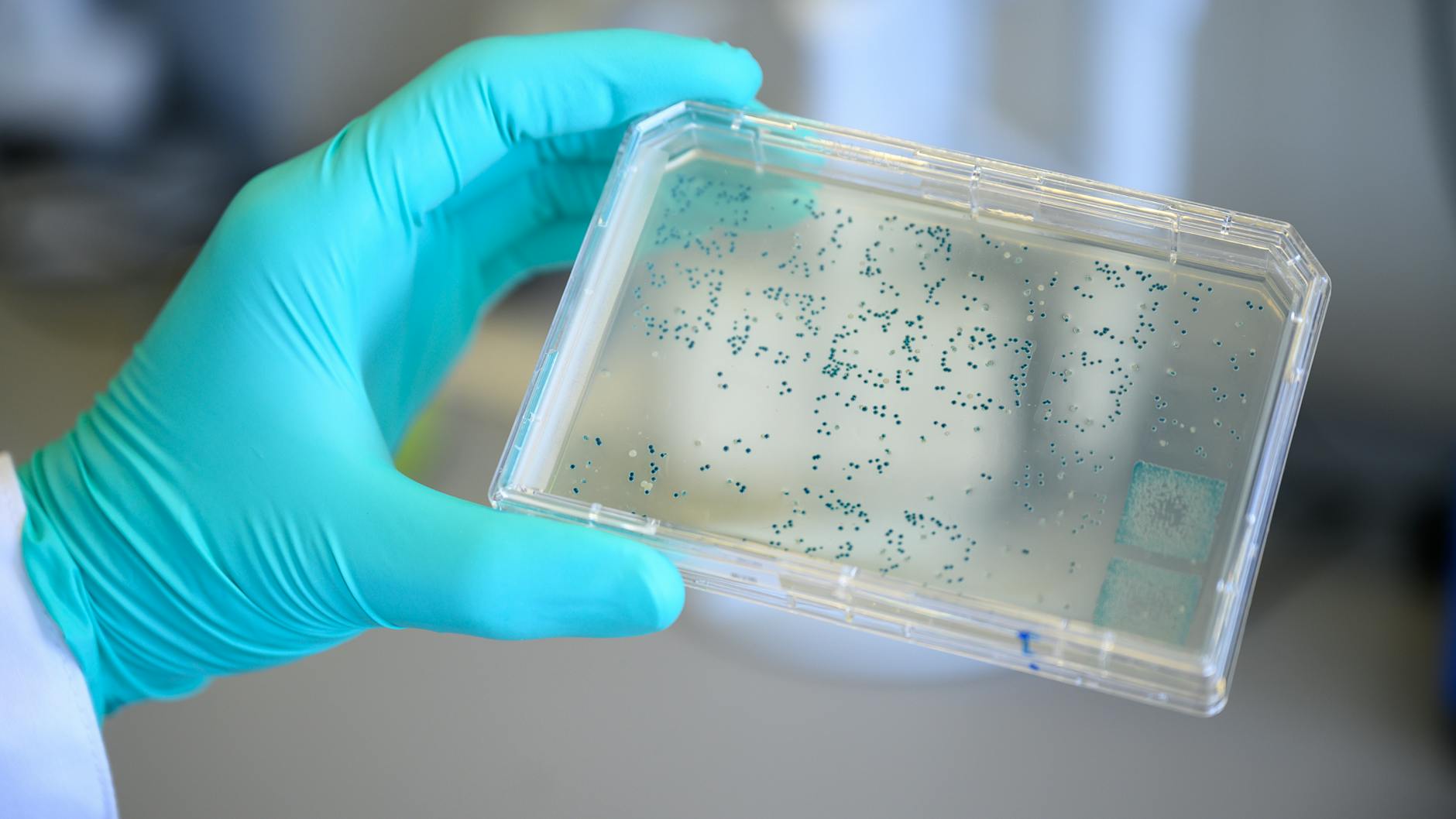 Weltweit wird an Corona-Impfstoffen geforscht, wie hier beim Tübinger Unternehmen Curevac. Dort hält ein Mitarbeiter einen Träger mit Bakterien in der Hand.