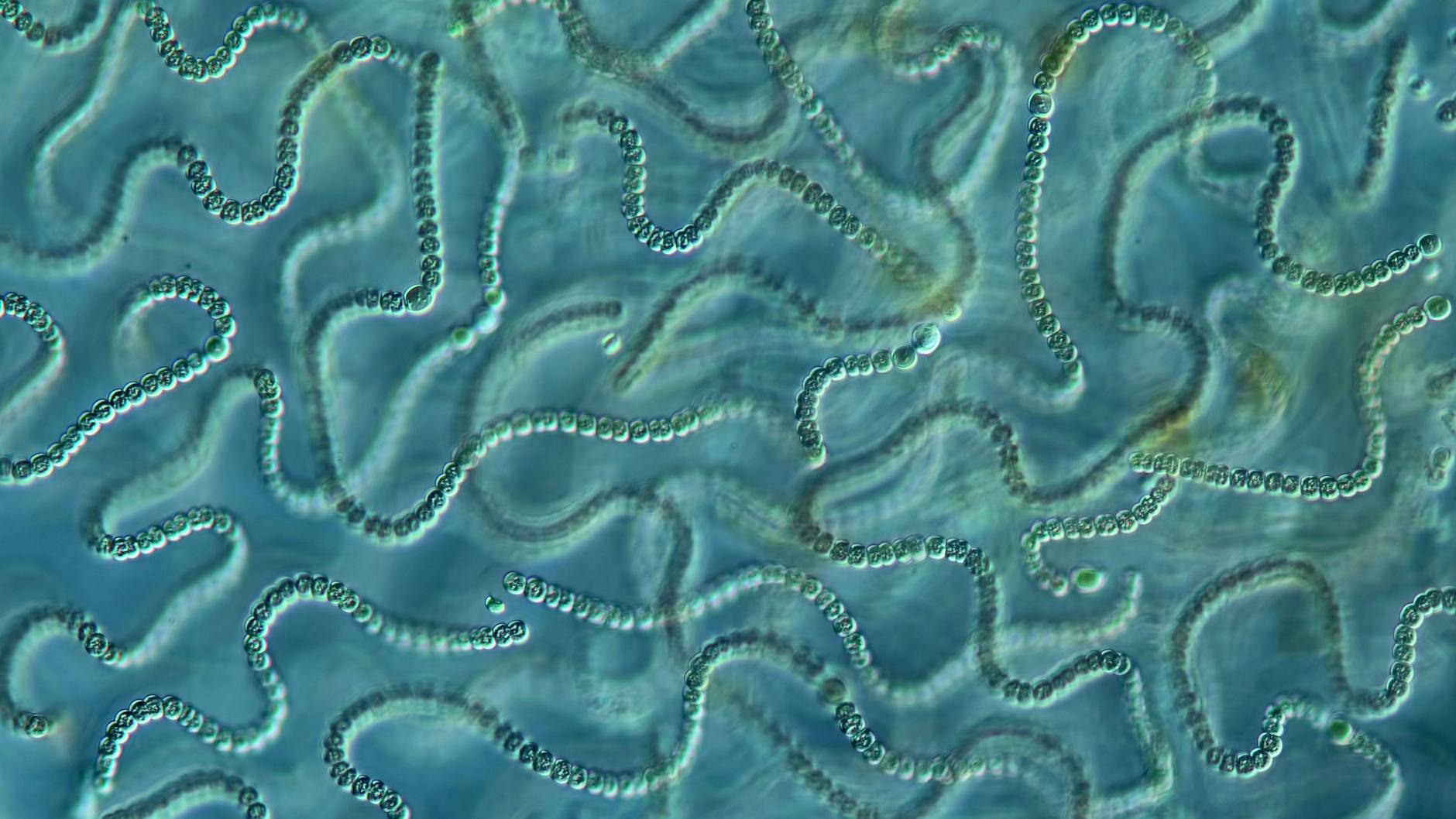 Cyanobakterien: Unter dem Mikroskop sind sie dekorativ, in Badegewässern eine Gefahr für die Gesundheit.