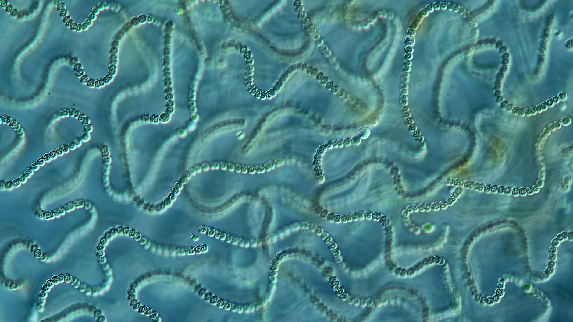 Cyanobakterien: Unter dem Mikroskop sind sie dekorativ, in Badegewässern eine Gefahr für die Gesundheit.