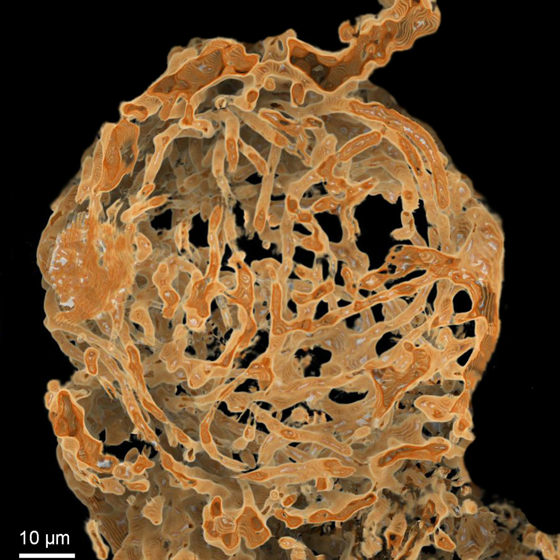 Rekonstruktion eines der beiden Speicherorgane für Spermien aus einem Weibchen der kreidezeitlichen Myanmarcypris hui.