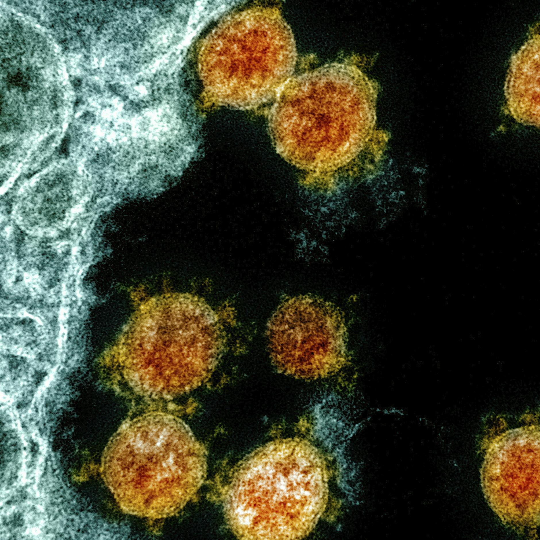 Was hat es zu bedeuten, dass Sars-CoV-2 mutiert und verschiedene Varianten gefunden wurden?