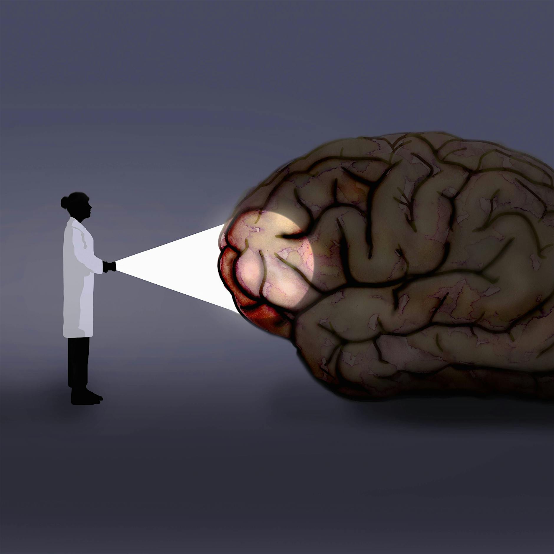 Multiple Sklerose: Auf den Spuren einer unheimlichen Krankheit