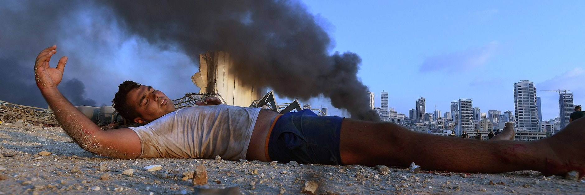 Ein verletzter Junge liegt am 4. August 2020 auf der Erde, eine Rauchsäule und die Reste eines Getreidesilos zeugen von der Explosion, die Bürger der Stadt wie von einer Atombombe beschrieben.