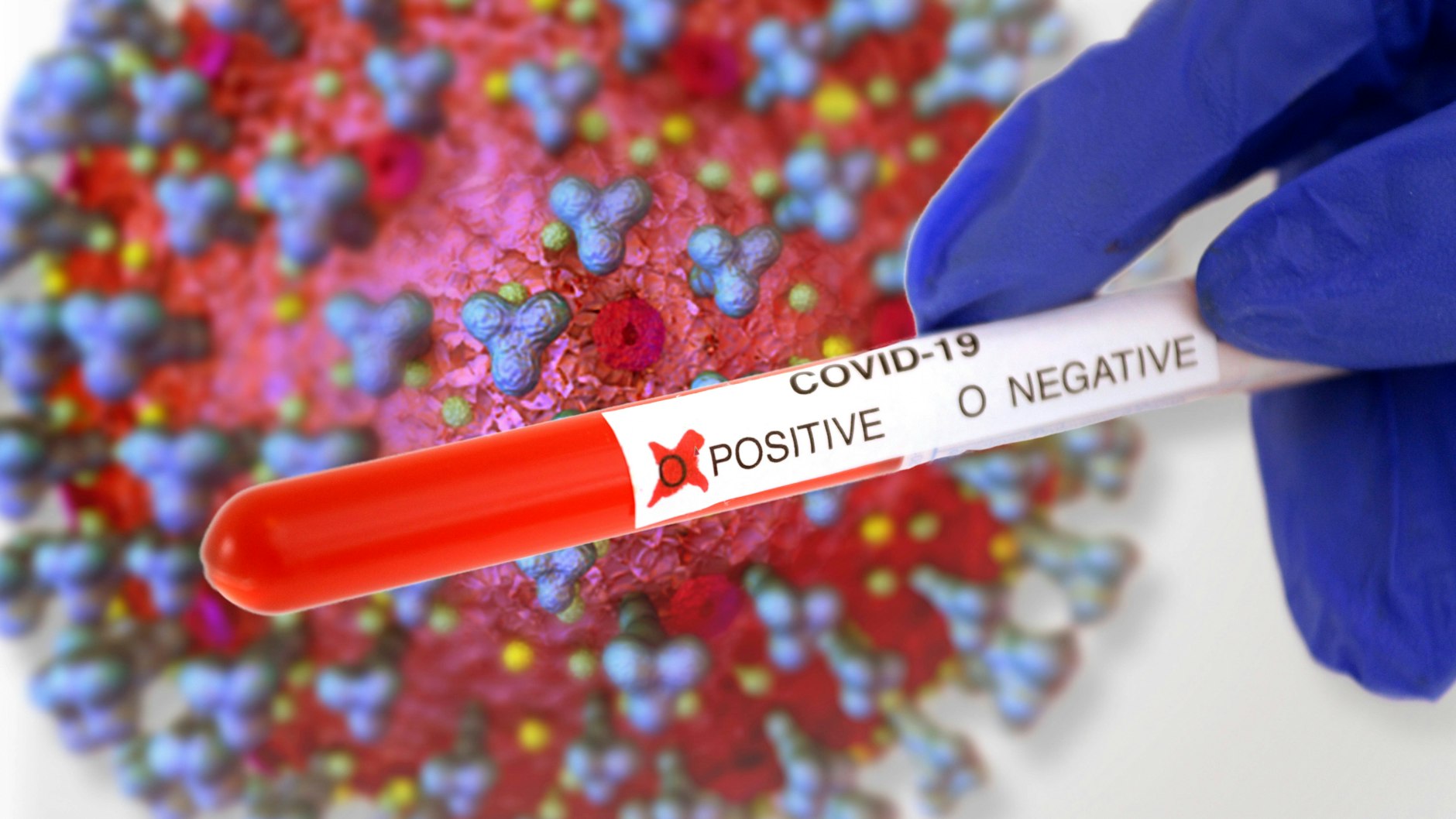 Die Sieben-Tage-Inzidenz steigt in Deutschland seit Wochen wieder an (Symbolbild).