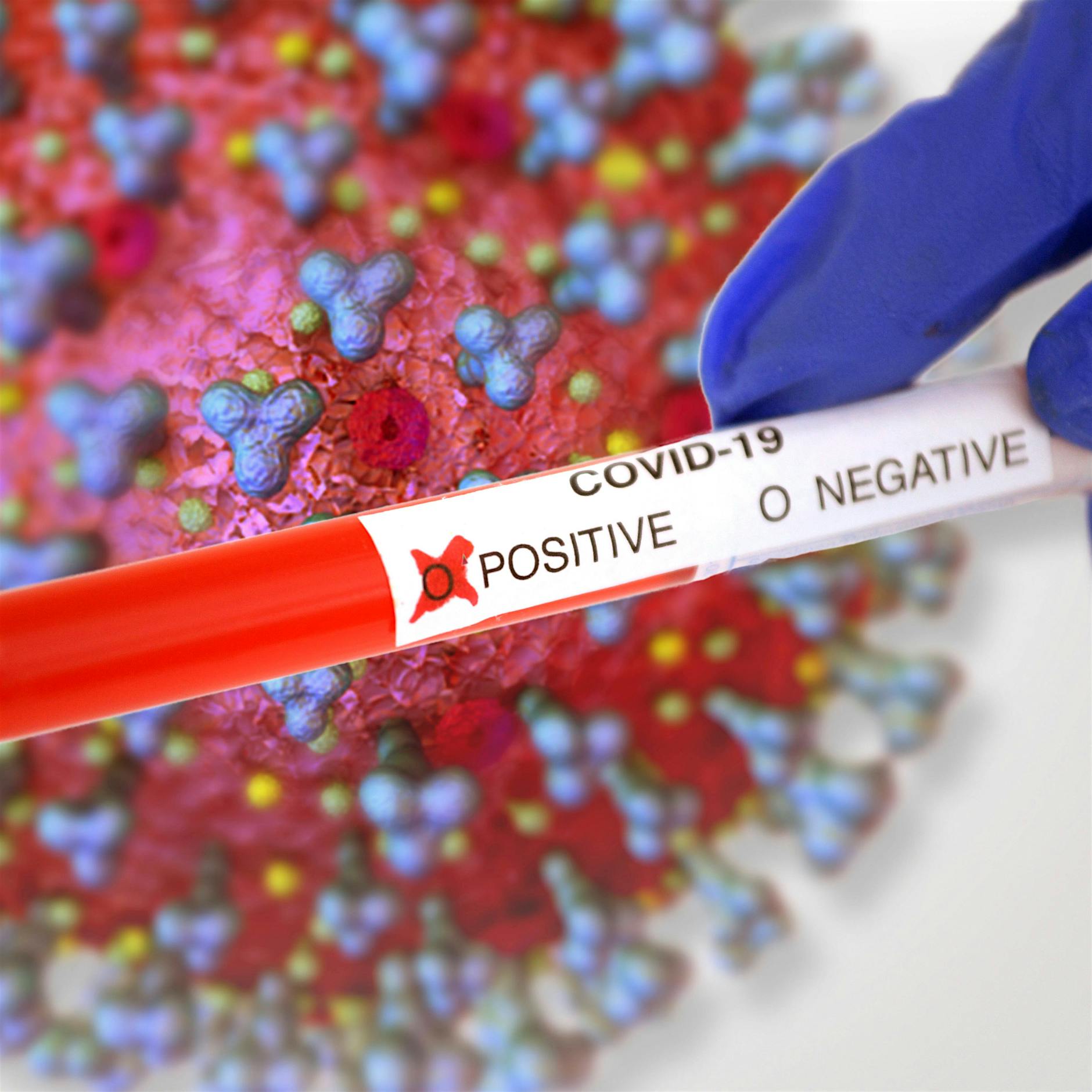 Corona in Berlin: 358 Neuinfektionen – Inzidenz steigt auf 44,4