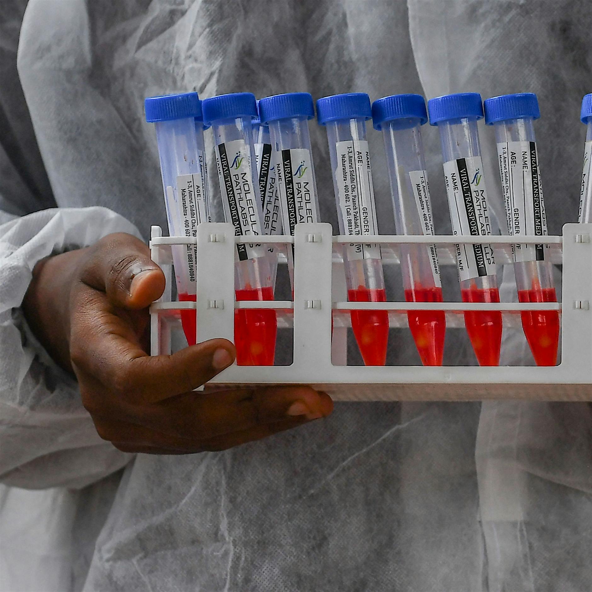 Robert-Koch-Institut sieht Beginn der vierten Pandemie-Welle