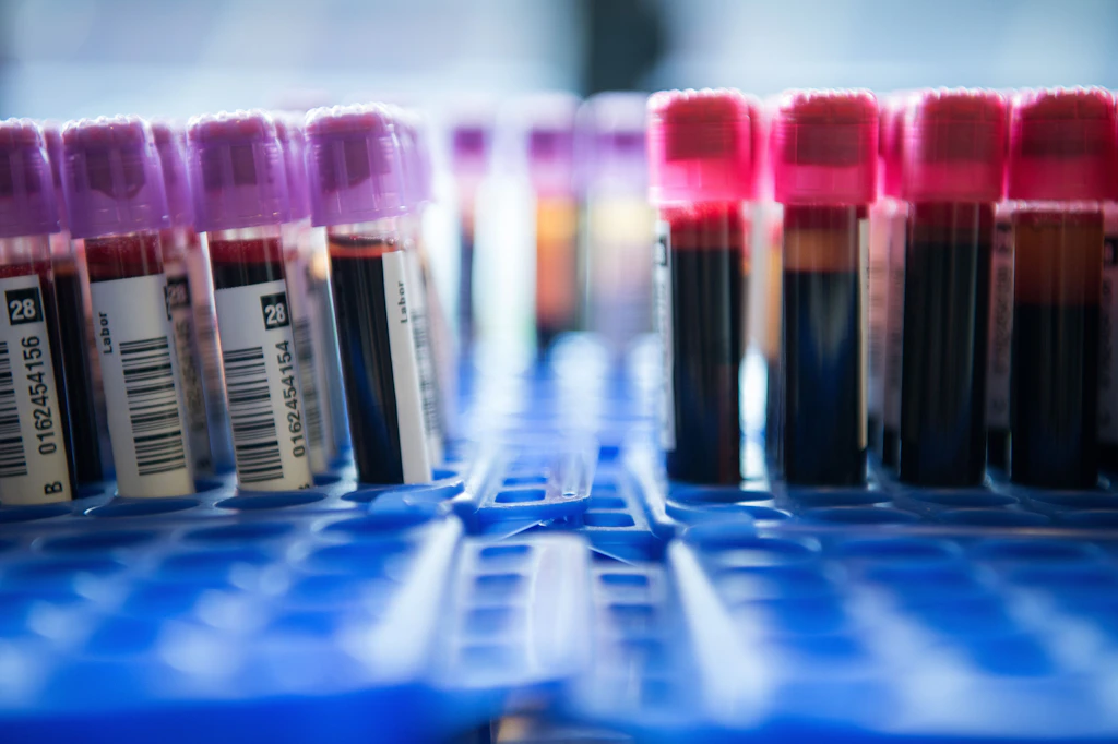 Liquid Biopsy: Bluttest soll Vielzahl von Krebsarten erkennen