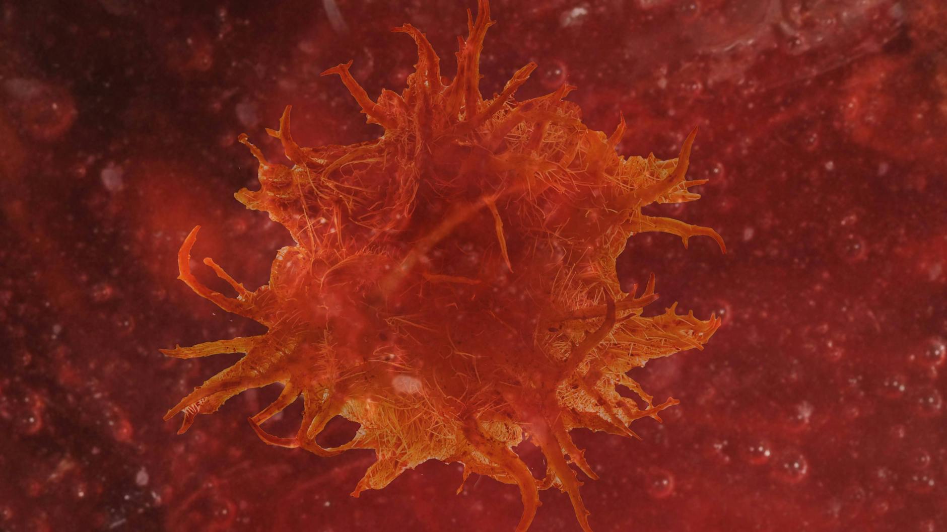 Eine Karzinomzelle im Blut