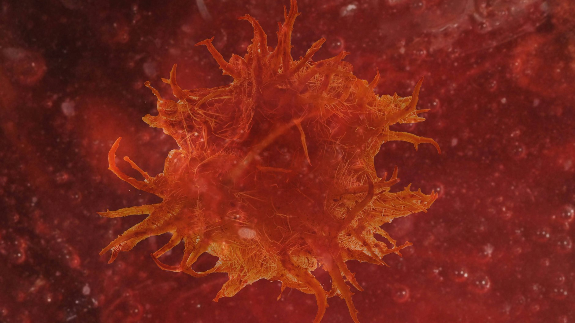 Eine Karzinomzelle im Blut