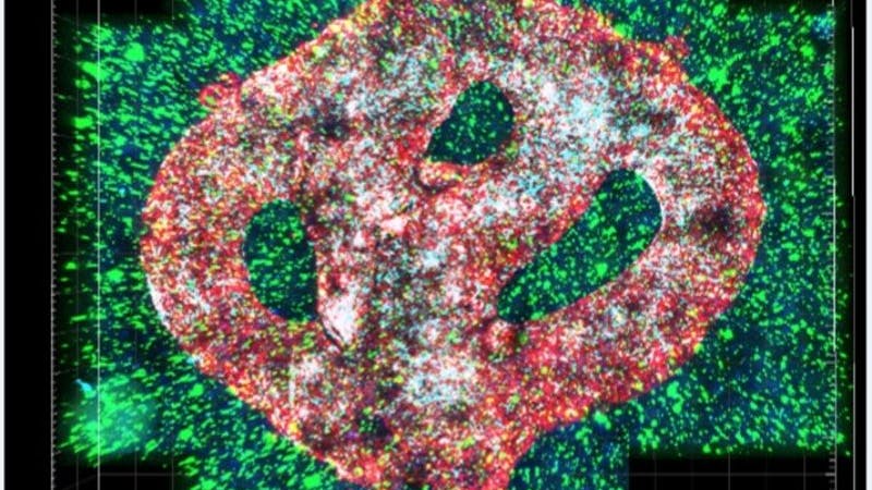 Mikroskopische Aufnahme des Modells eines Hirntumors (Glioblastom), das per 3D-Biodruck geschaffen wurde. Die Hirnzellen sind grün, die Tumorzellen blau, die Blutgefäße rot dargestellt.