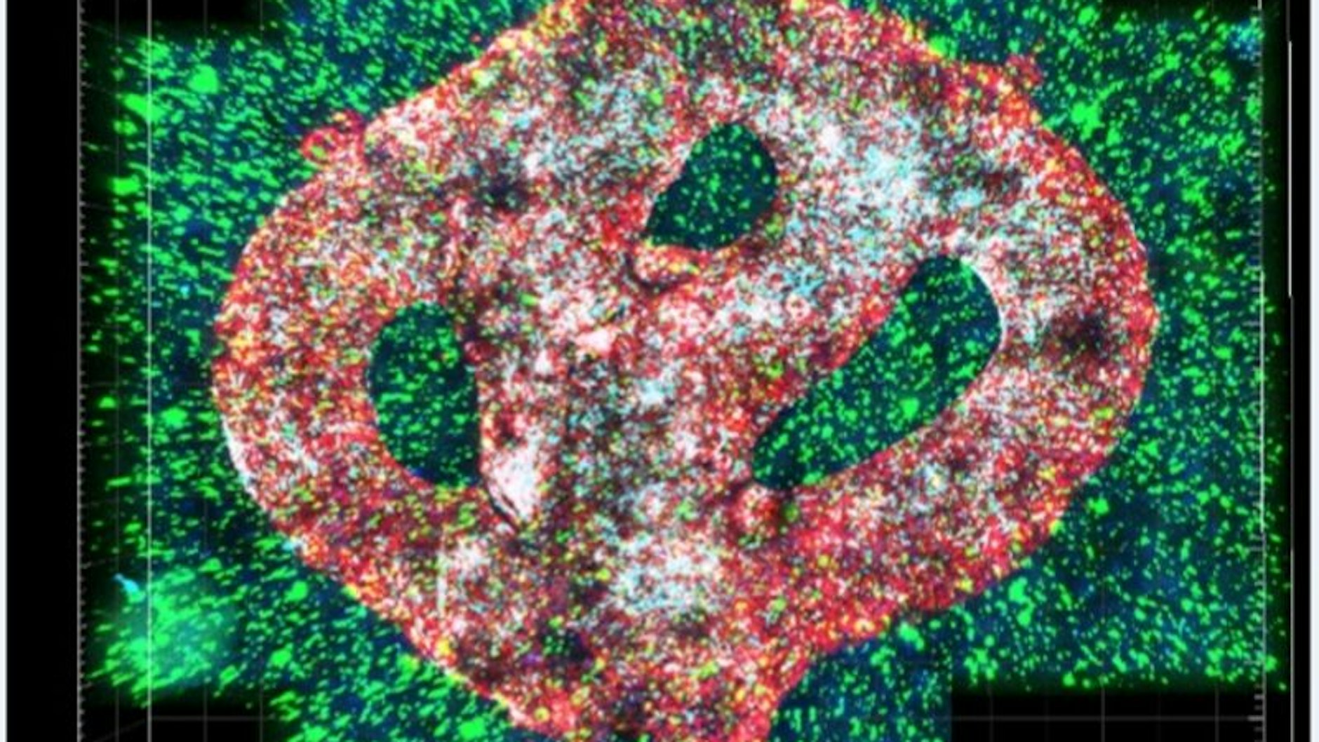 Mikroskopische Aufnahme des Modells eines Hirntumors (Glioblastom), das per 3D-Biodruck geschaffen wurde. Die Hirnzellen sind grün, die Tumorzellen blau, die Blutgefäße rot dargestellt. 