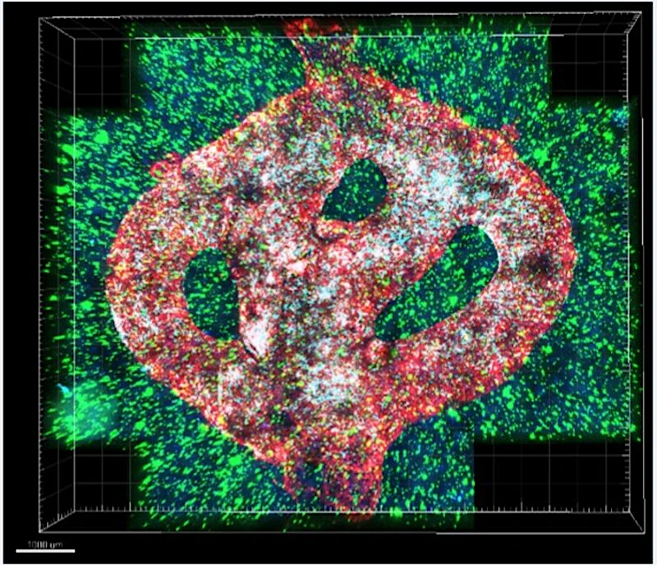 Mikroskopische Aufnahme des Modells eines Hirntumors (Glioblastom), das per 3D-Biodruck geschaffen wurde. Die Hirnzellen sind grün, die Tumorzellen blau, die Blutgefäße rot dargestellt. 