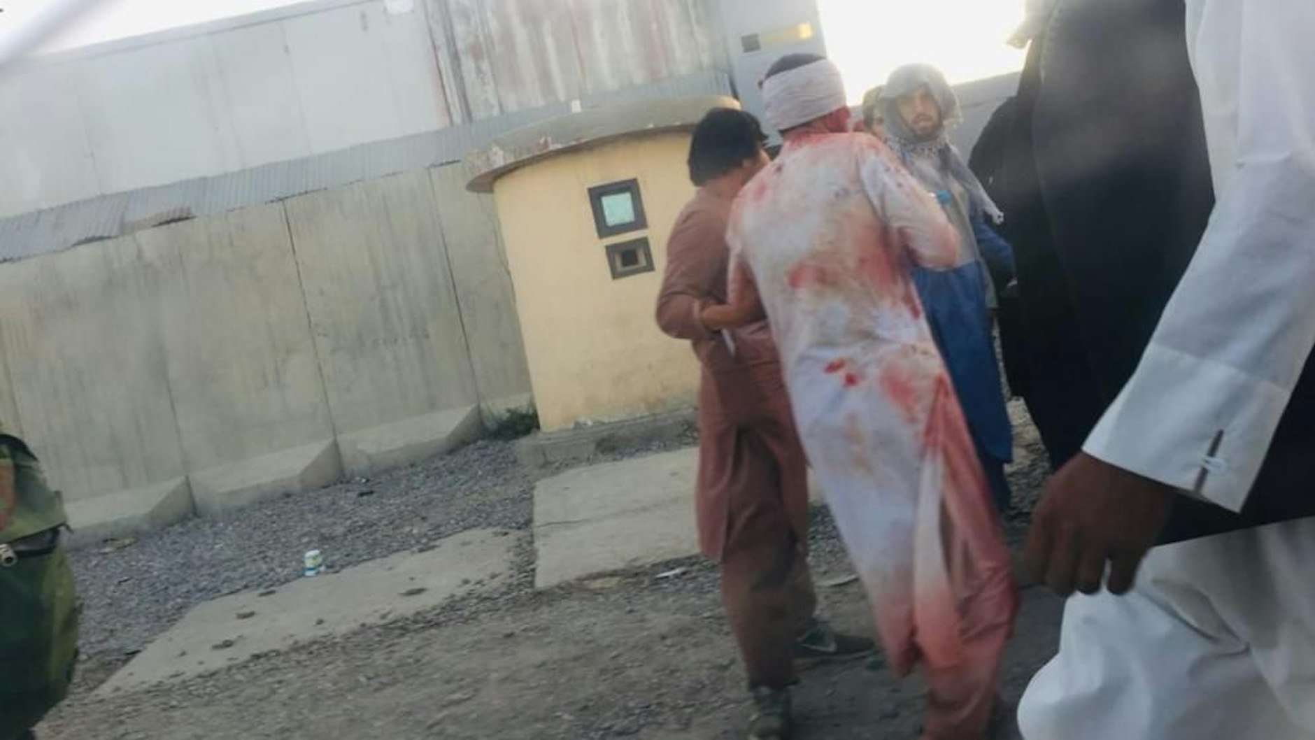 Auf diesem Bild soll ein Verletzter nach der Explosion zu sehen sein.