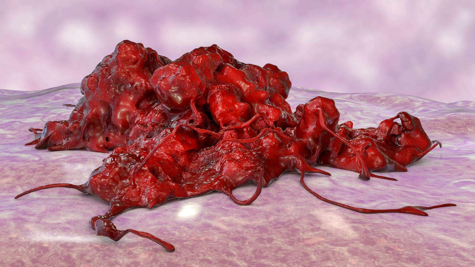 Computer-Illustration einer Krebszelle. Künftig können manche Tumore vielleicht mit gezielten mRNA-Injektionen erfolgreich behandelt werden.