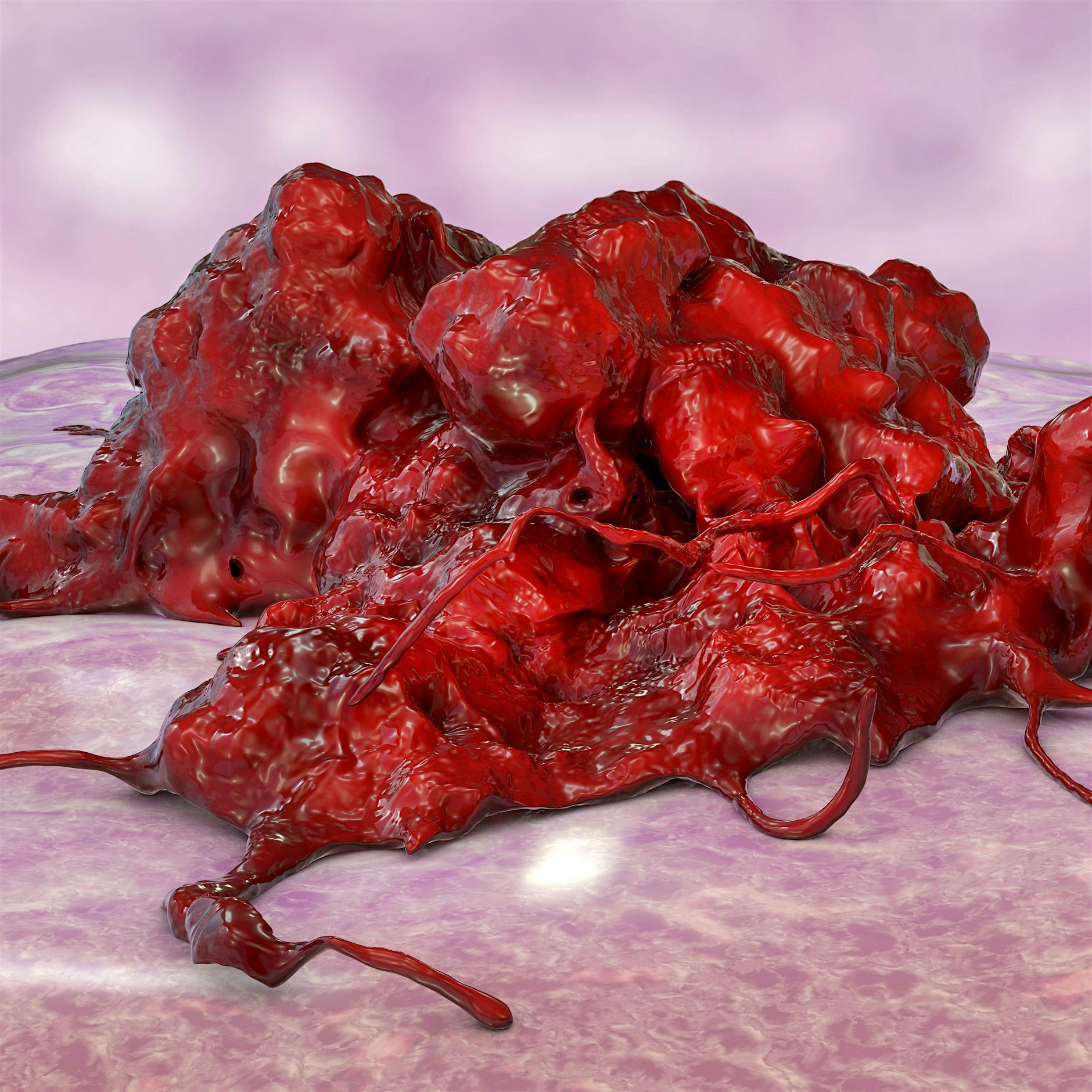 Immunspritze gegen Krebs: Deutsche Forscher testen mRNA auch gegen Tumore