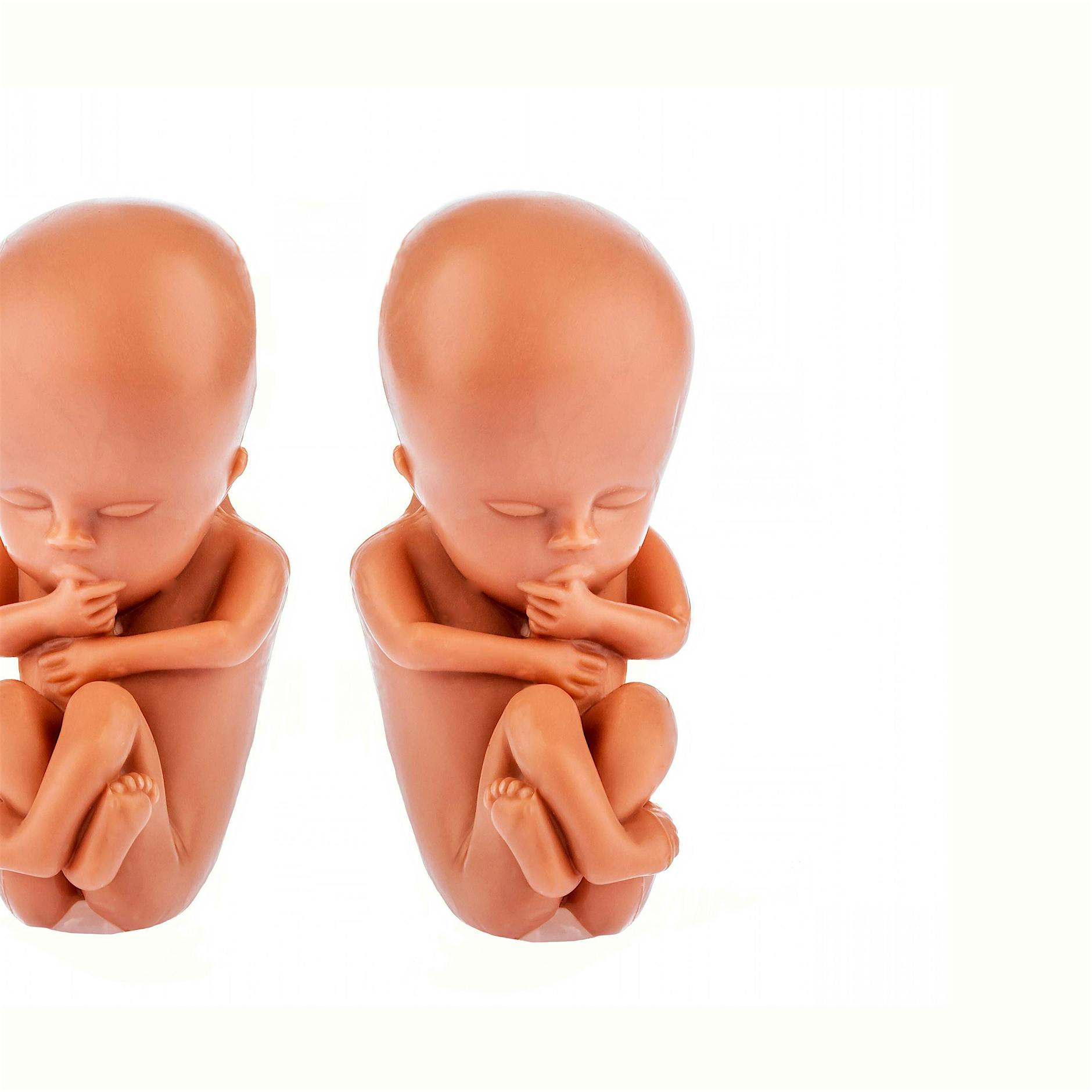 Jedes siebte Paar: Auch bei eineiigen Zwillingen gibt es genetische Unterschiede