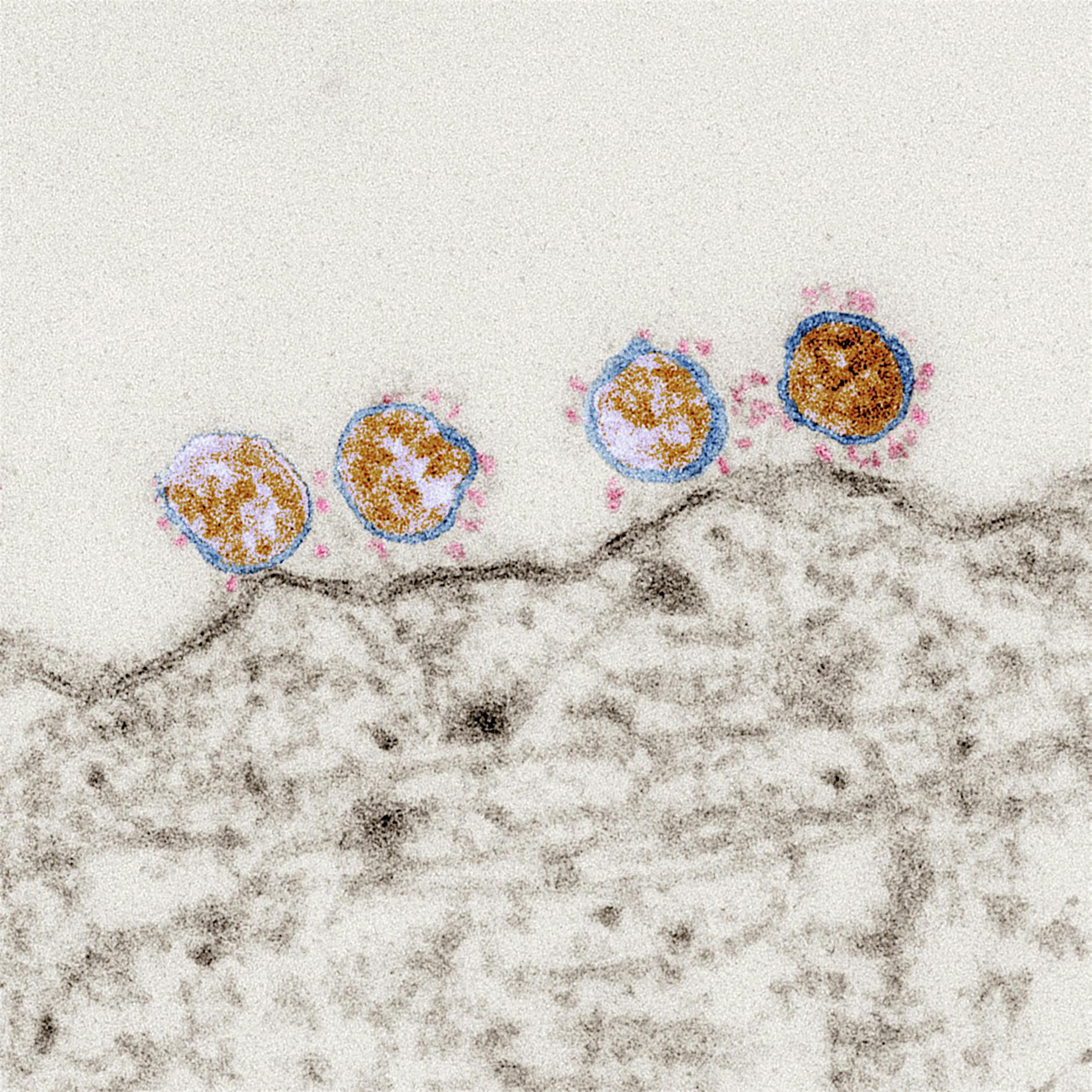 Medikament gegen Covid: Virusblocker und Antikörper-Cocktails versprechen Erfolg