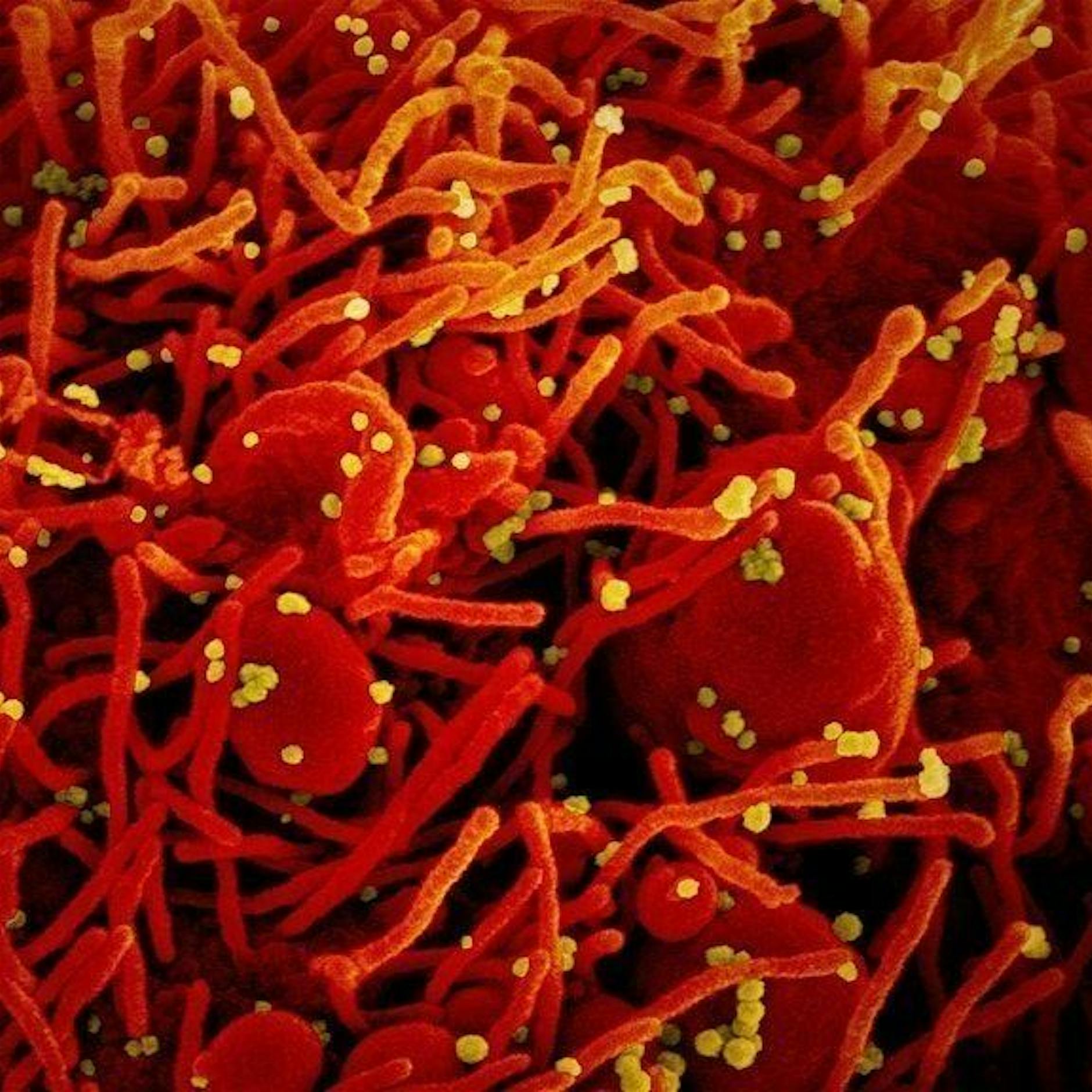 Neuer Höchststand: 76 Corona-Tote an einem Tag in Berlin