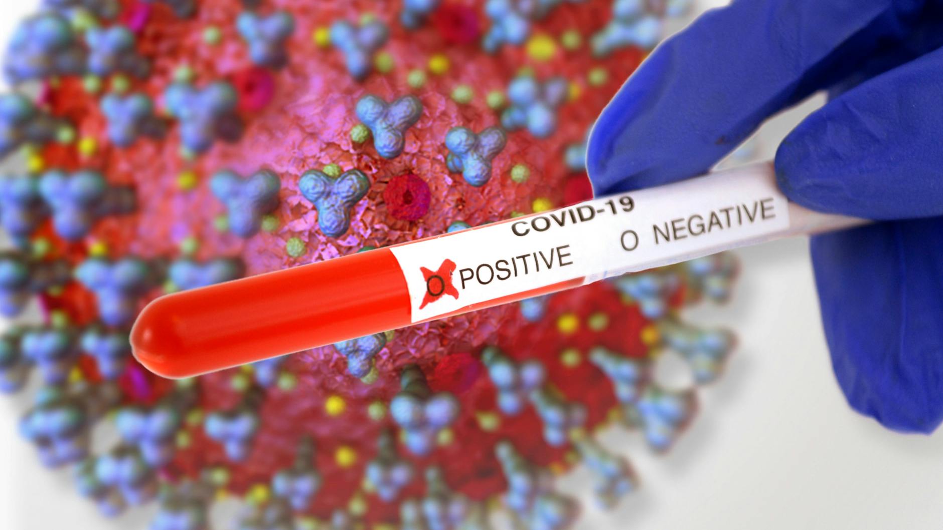 Das Coronavirus hat bislang nach offiziellen Angaben 2.040.659 Menschen infiziert.