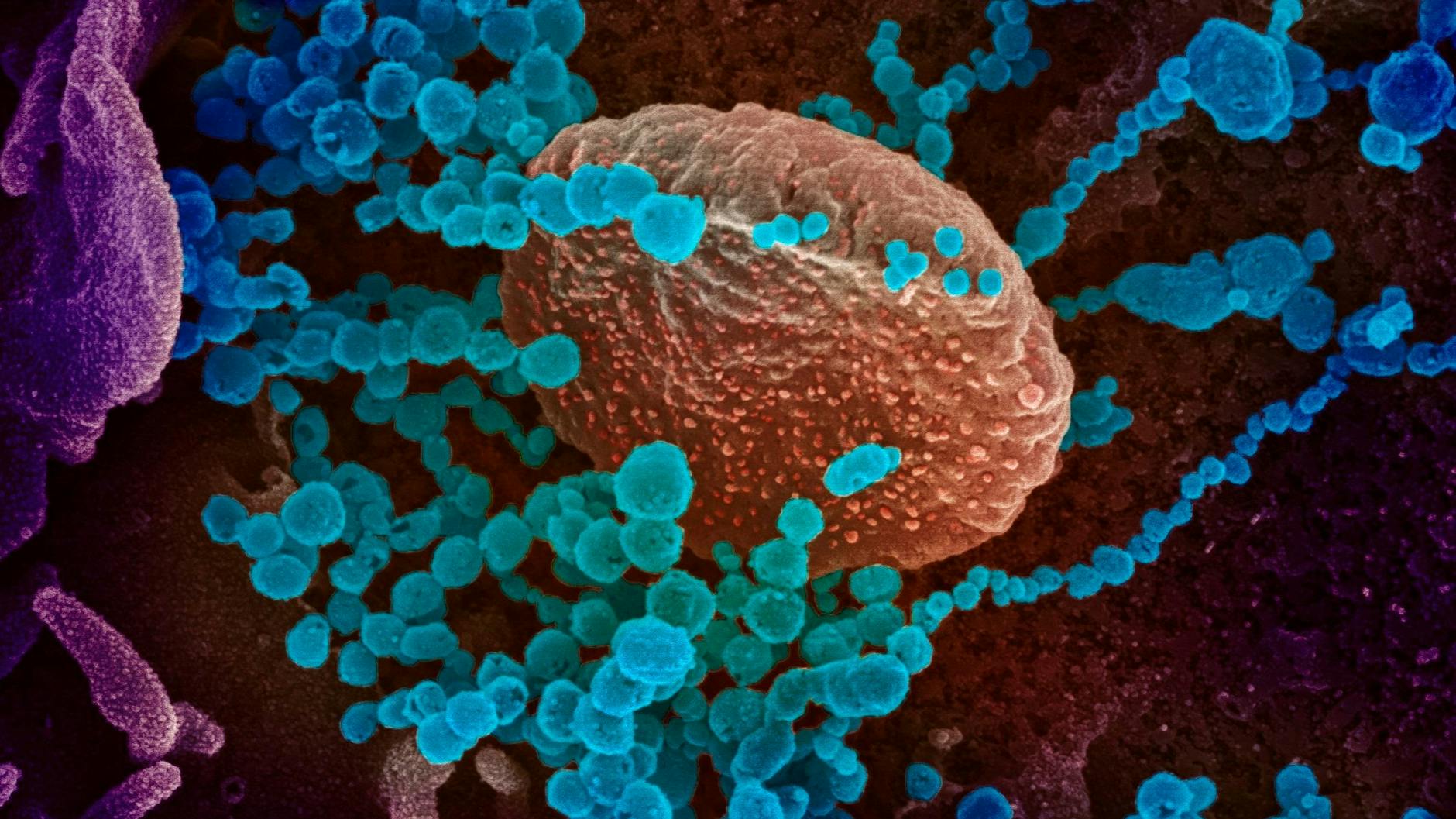 Aufgenommen bei einem Laborversuch: Sars-CoV-2 (blau) wird aus einer infizierten Zelle freigesetzt. 