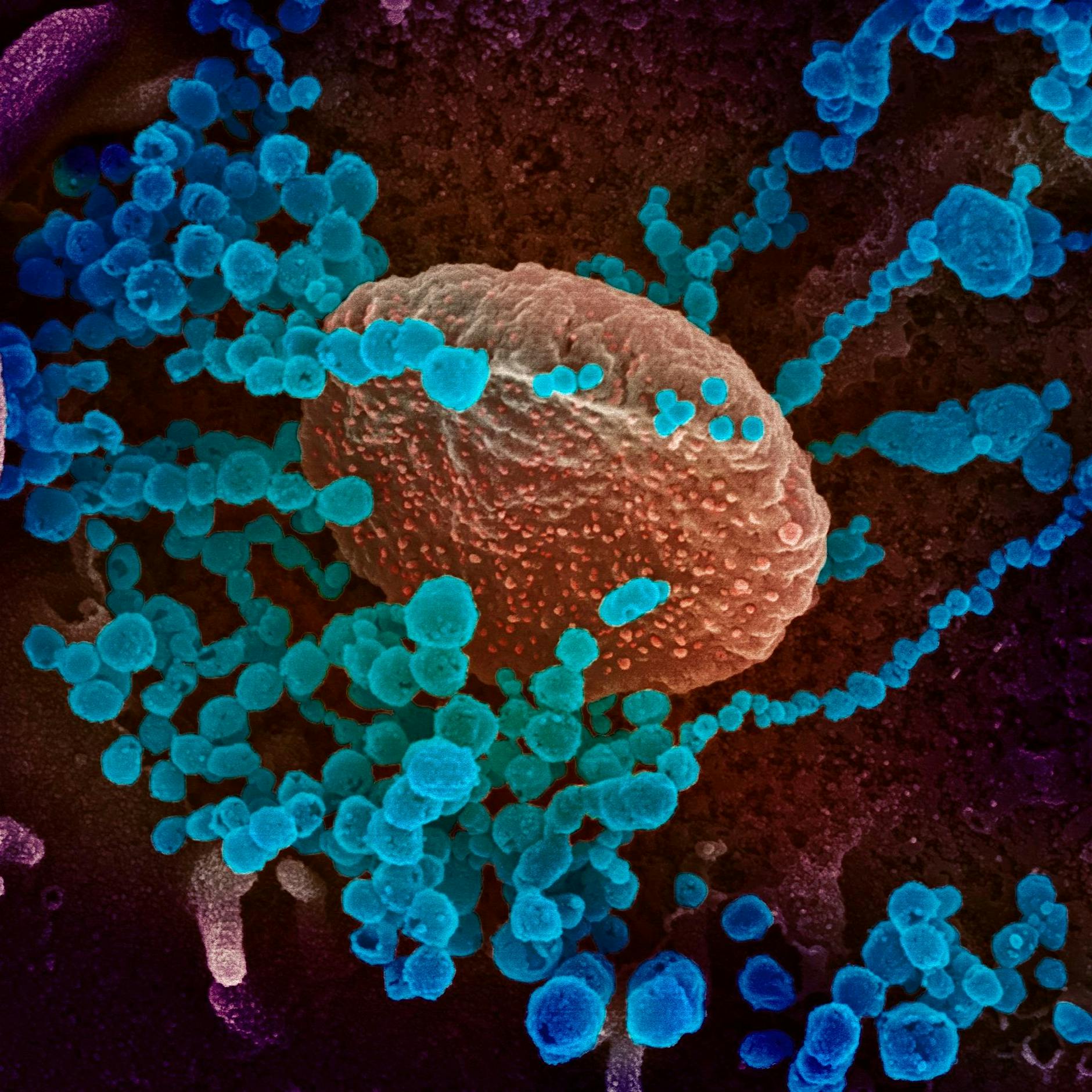 Neue Coronavarianten: Das sollten Sie über die Mutationen wissen