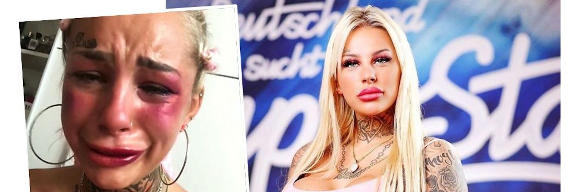 Ex-Kandidatin Leonie (22) schockt mit diesem Foto auf Instagram.