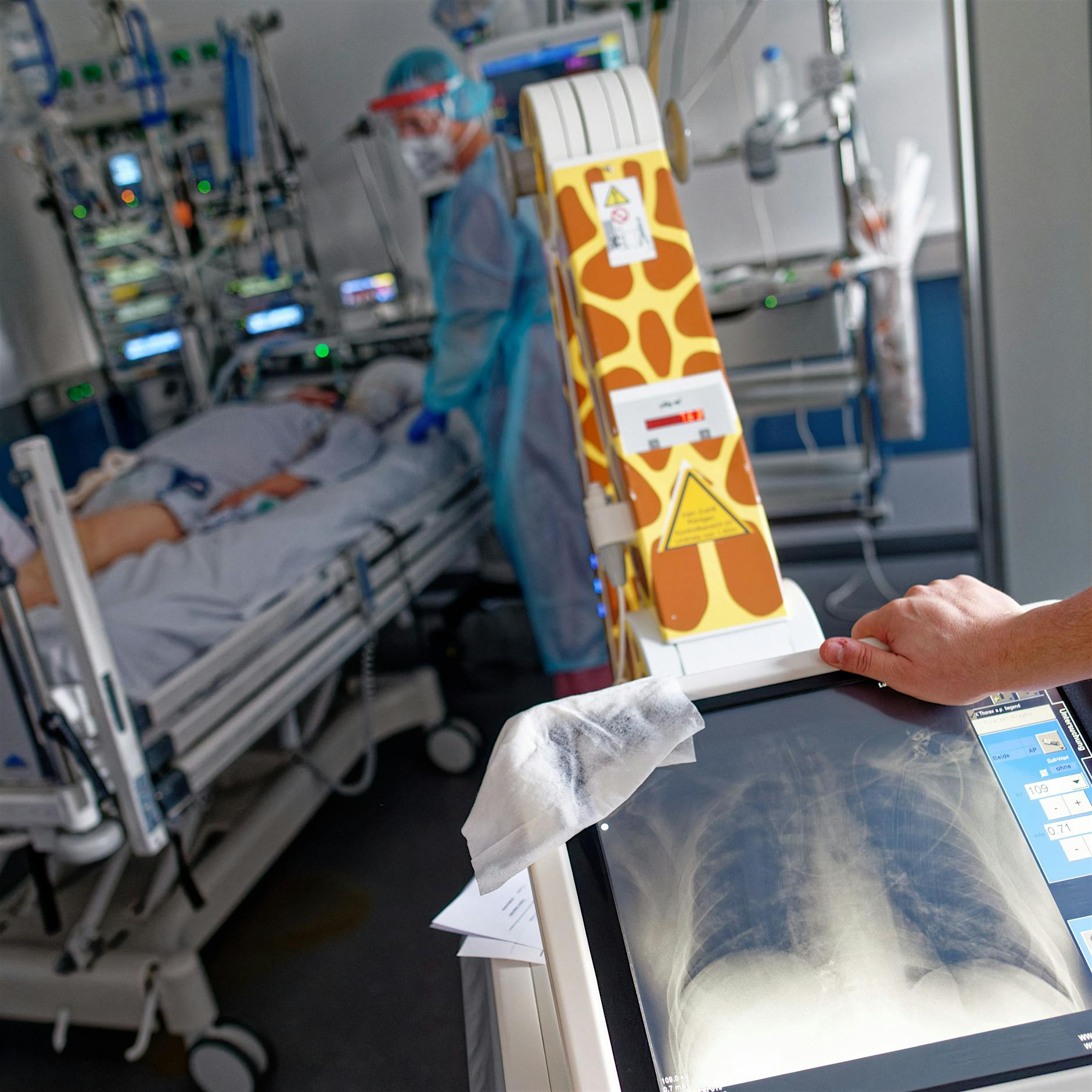 Berliner Forscher: Gegen schwere Corona-Verläufe beim Immunsystem ansetzen