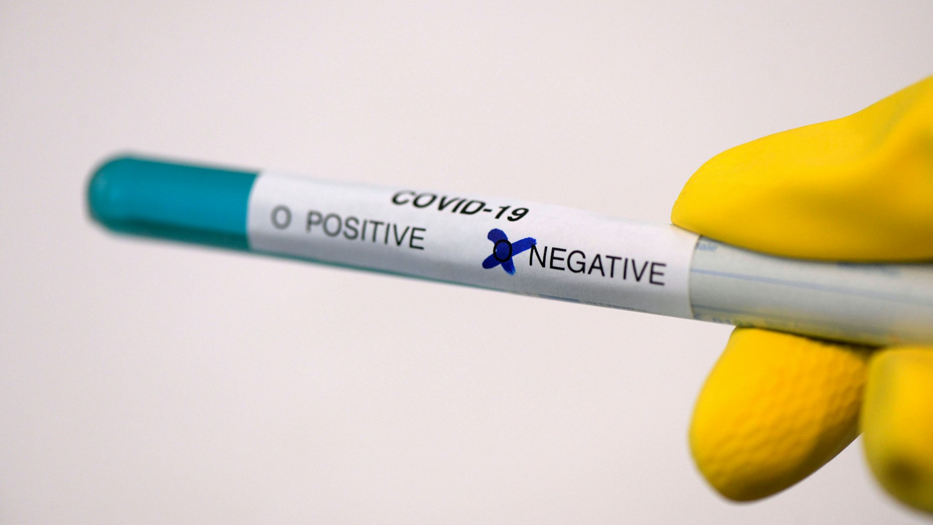 Dieser Corona-Test ist negativ ausgefallen (Symbolbild).