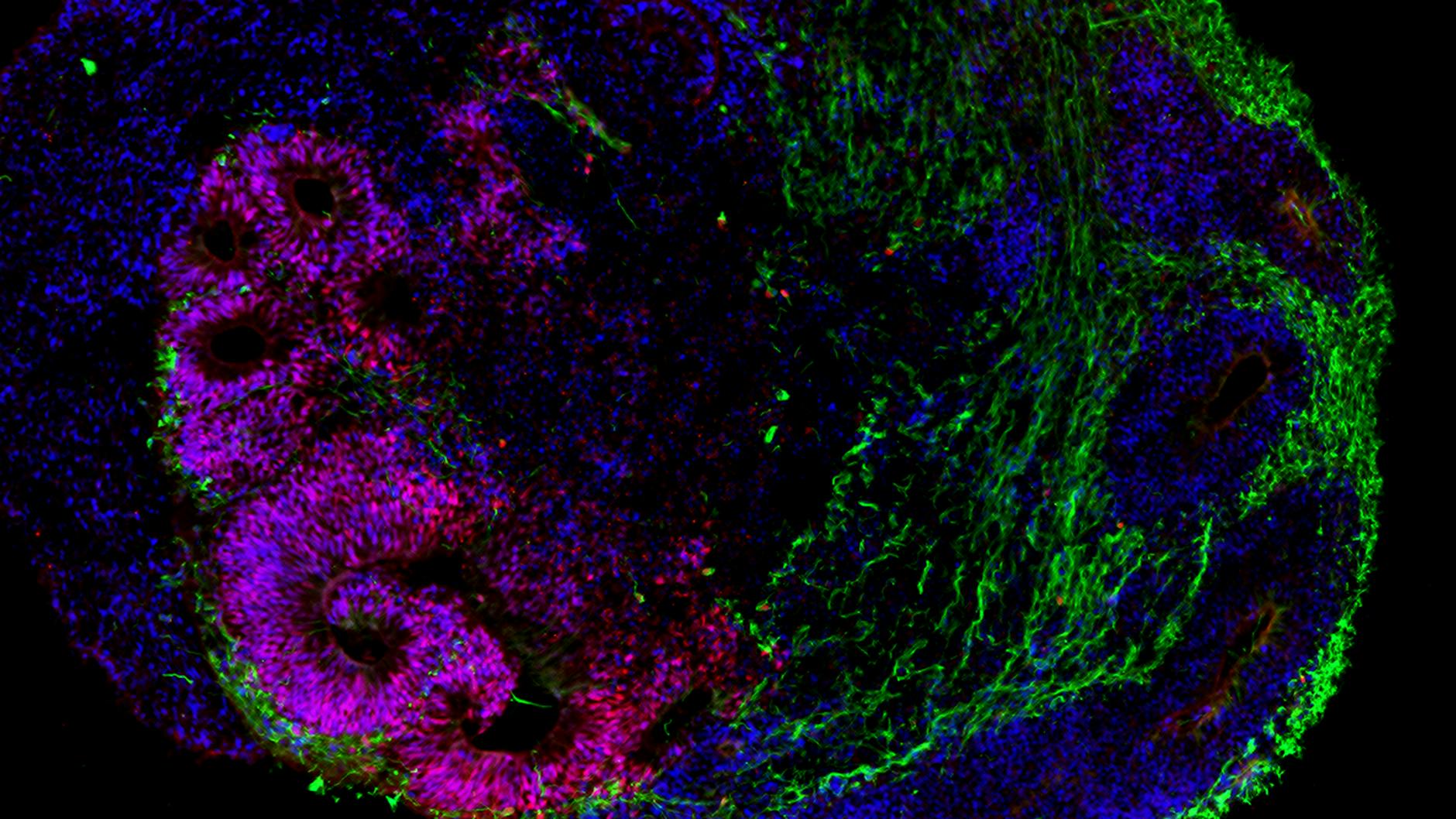 Die neue Zellklinik arbeitet auch mit gezüchteten Mini-Organen, sogenannten Organoiden. Hier der Schnitt durch ein Gehirn-Organoid im Frühstadium, nach 30 Tagen. Zu sehen ist die Entwicklung der Großhirnrinde. Die Neuronen sind grün dargestellt, verschiedene Vorläuferzellen rot und blau.