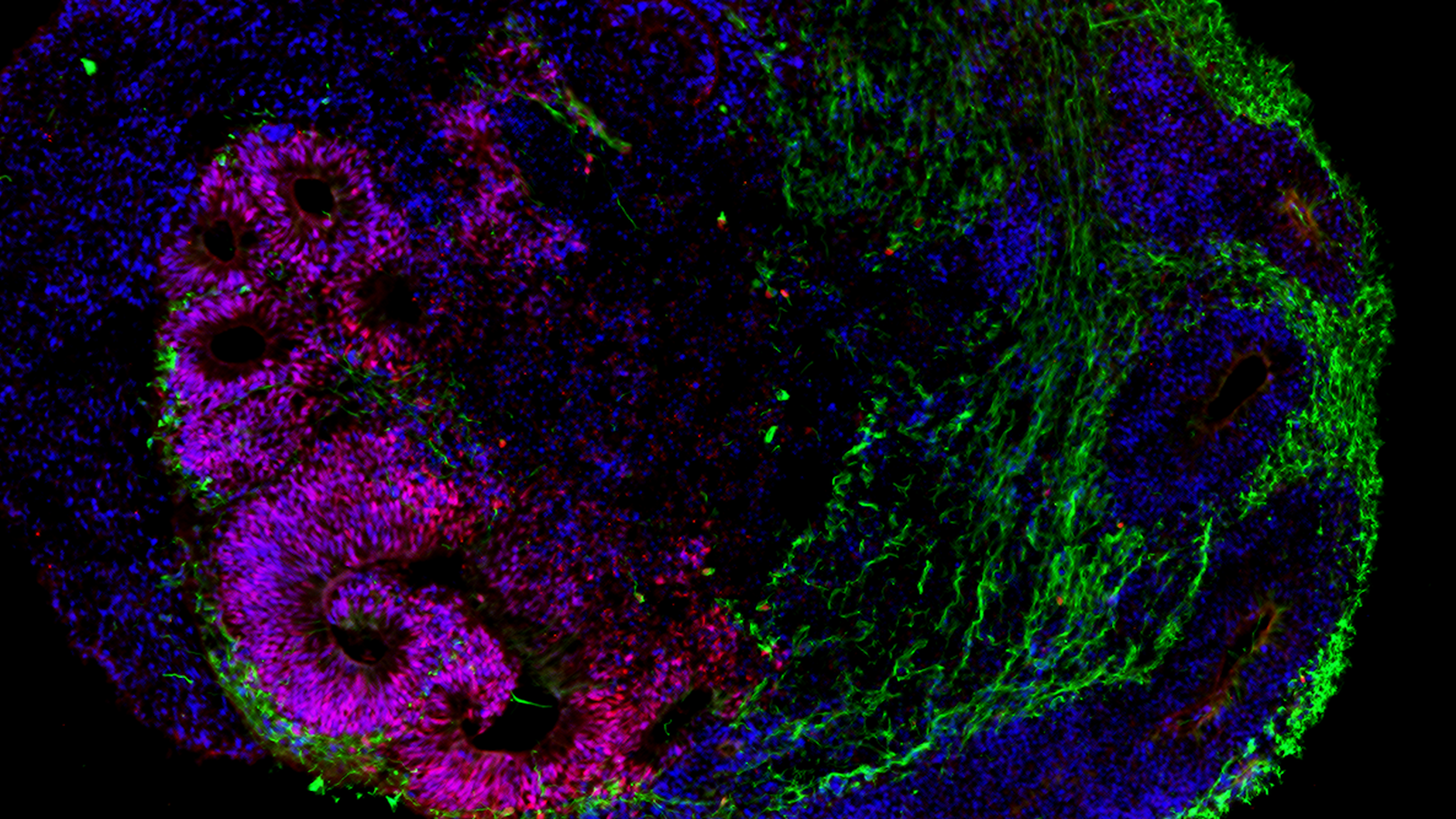 Die neue Zellklinik arbeitet auch mit gezüchteten Mini-Organen, sogenannten Organoiden. Hier der Schnitt durch ein Gehirn-Organoid im Frühstadium, nach 30 Tagen. Zu sehen ist die Entwicklung der Großhirnrinde. Die Neuronen sind grün dargestellt, verschiedene Vorläuferzellen rot und blau.