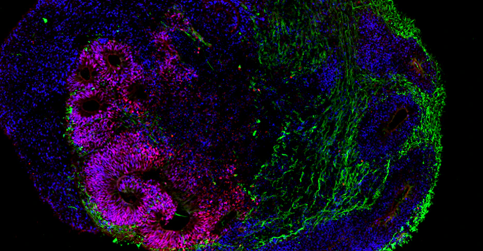 Die neue Zellklinik arbeitet auch mit gezüchteten Mini-Organen, sogenannten Organoiden. Hier der Schnitt durch ein Gehirn-Organoid im Frühstadium, nach 30 Tagen. Zu sehen ist die Entwicklung der Großhirnrinde. Die Neuronen sind grün dargestellt, verschiedene Vorläuferzellen rot und blau.