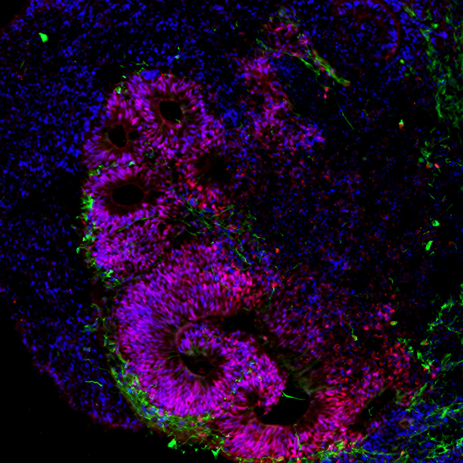 Neue Berliner Zellklinik: Revolution bei der Behandlung von Krebs und Alzheimer