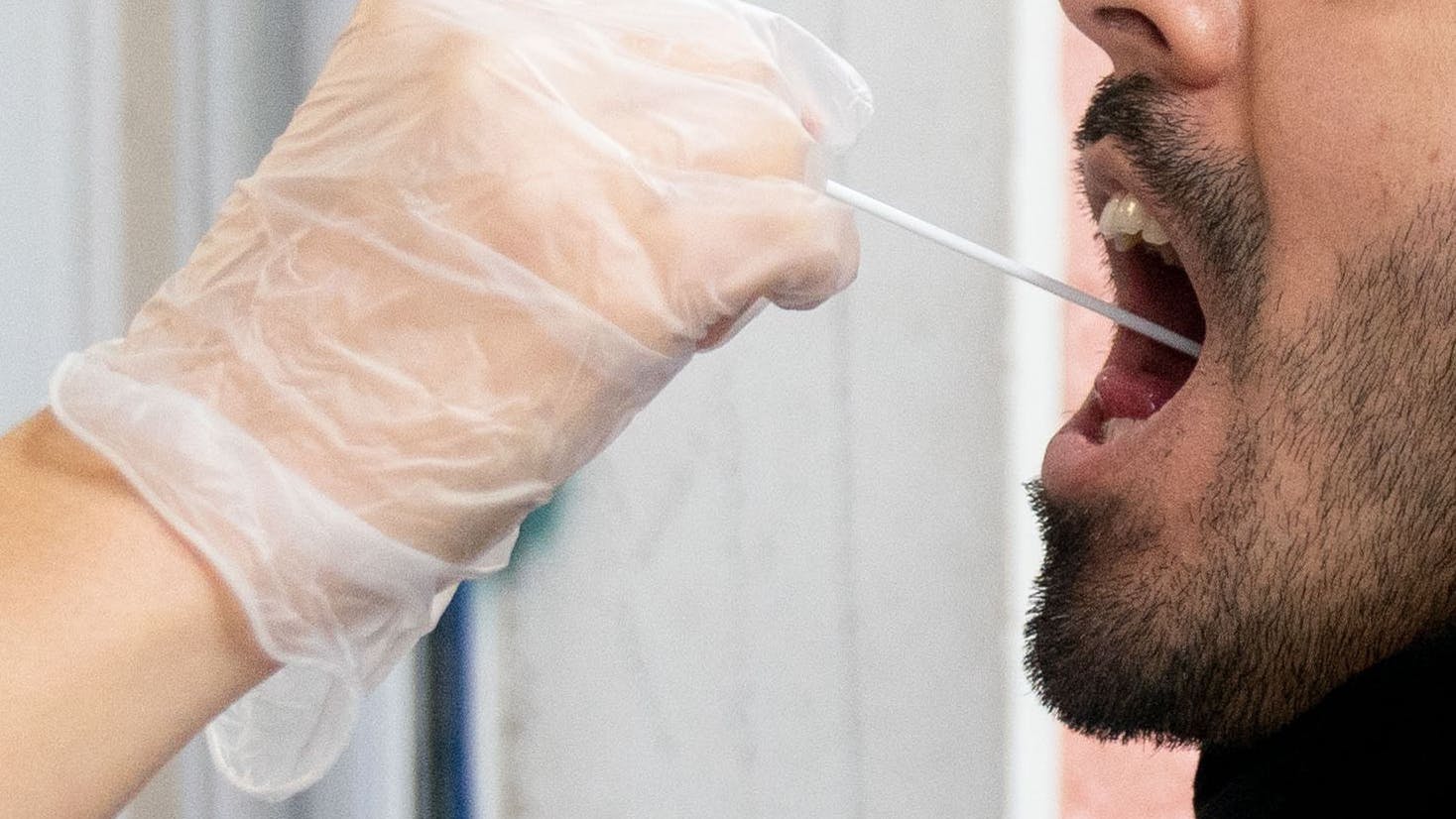 Ein Patient lässt vor einer Arztpraxis einen Abstrich für einen PCR Corona-Test machen. In Berlin sind die Corona-Infektionszahlen deutlich gestiegen (Symbolbild).