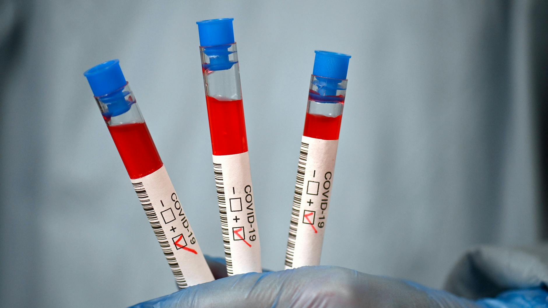 Bisher wurden 44 Corona-Fälle registriert – darunter 30 Schüler (Symbolbild). 