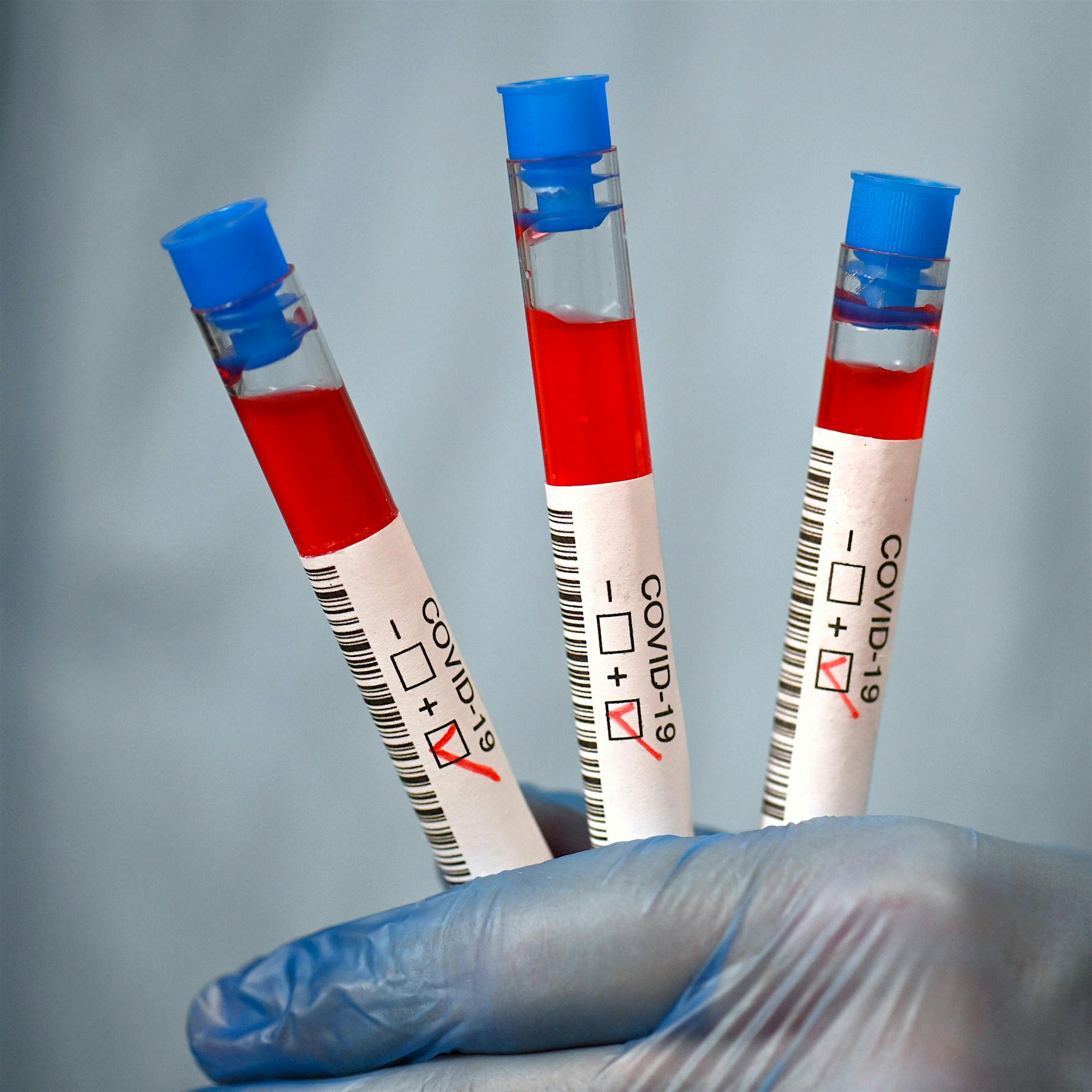 Corona-Ausbruch an Waldorfschule: 44 Infektionen nach Zirkusshows