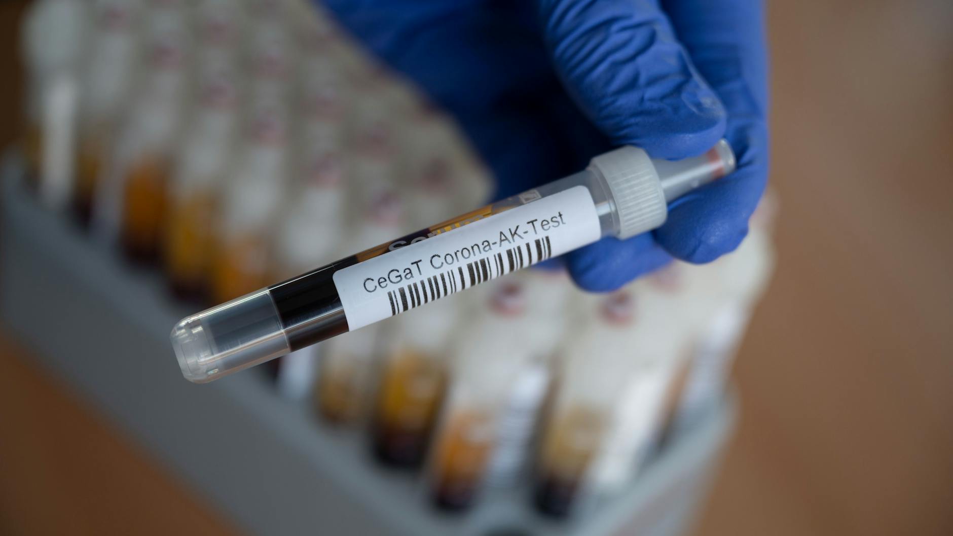 Eine Mitarbeiterin eines Tübinger Humangenetik-Labors hat ein Blutentnahmeröhrchen mit einer Blutprobe für einen Corona-Antikörper-Test in den Hand. 