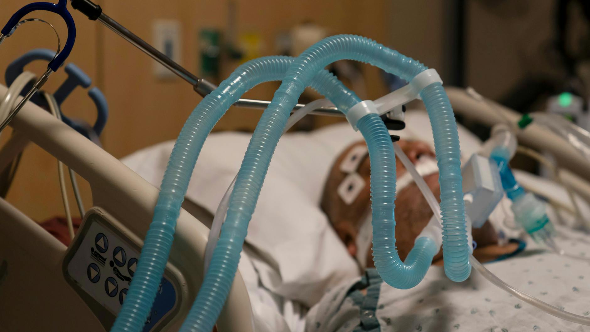Ein schwer an Covid-19 erkrankter Patient auf einer Intensivstation in den USA.