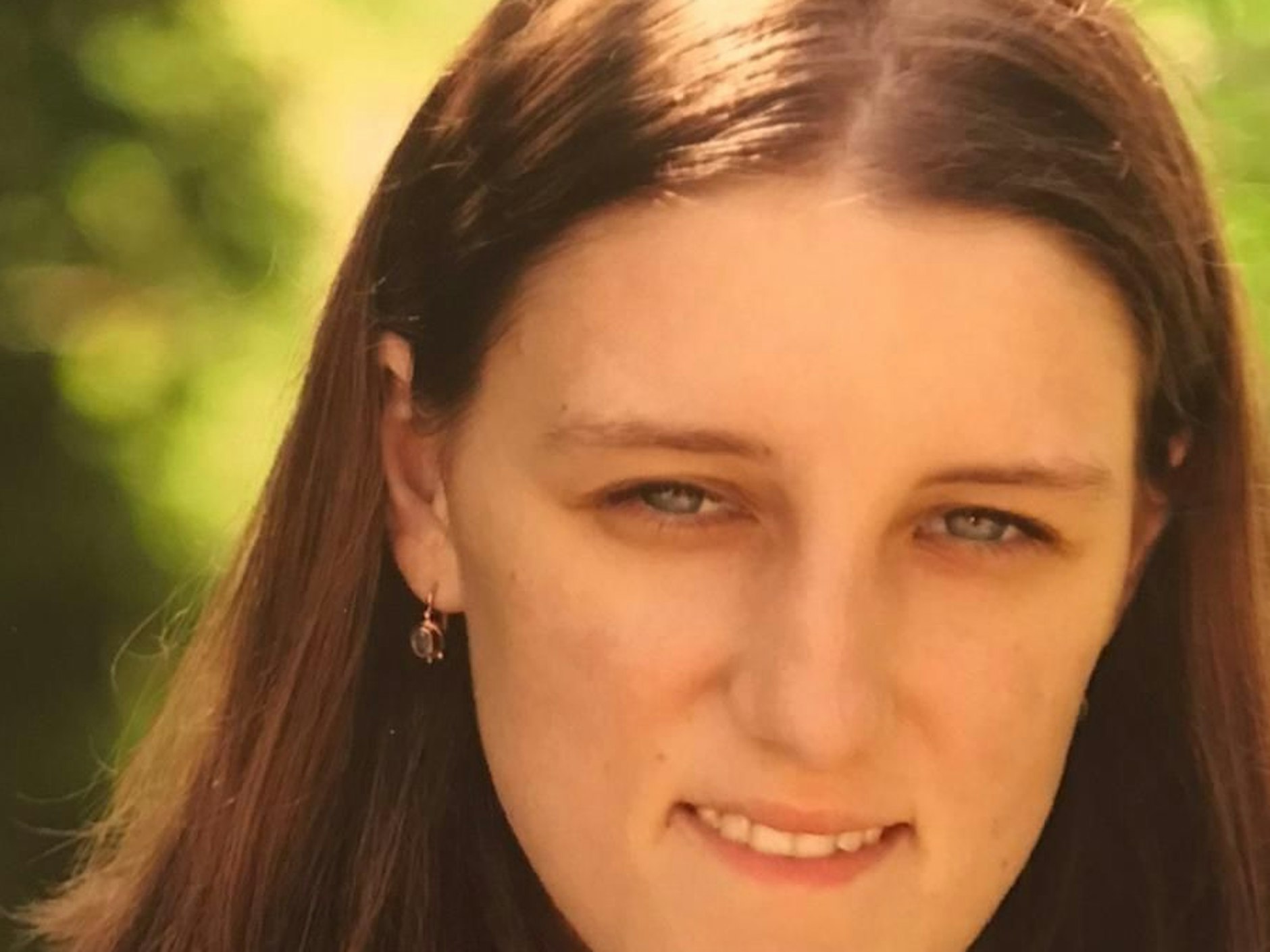 Schülerin Anastasia hat einen langen Leidensweg hinter sich. Sie kam mit einer Trichterbrust zur Welt.