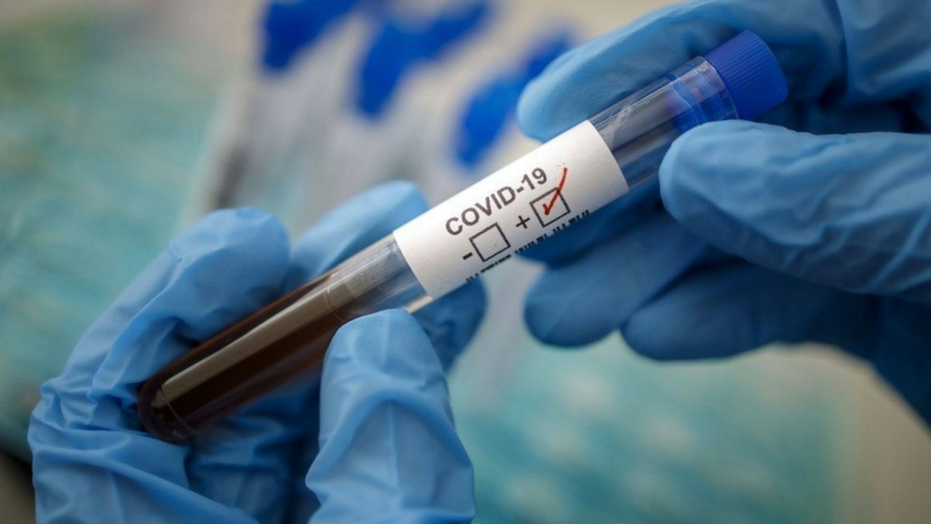 Ein positiver Corona-Test (Symbolbild). Der Inzidenzwert in Deutschland steigt.