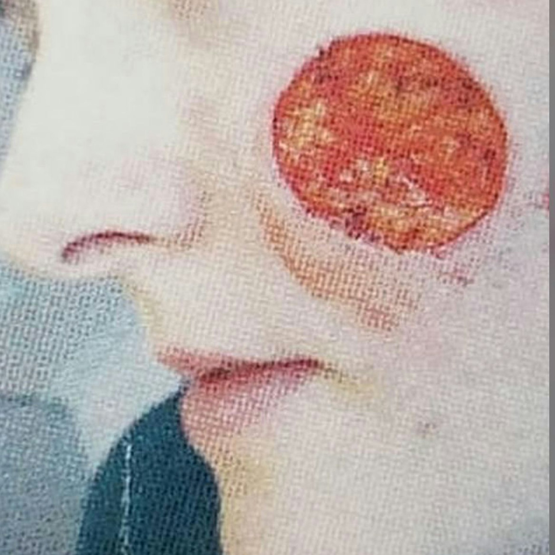 Die Chirurgen einer Hautklinik in Seattle mussten ihr ein tiefes Loch in die Wange schneiden.