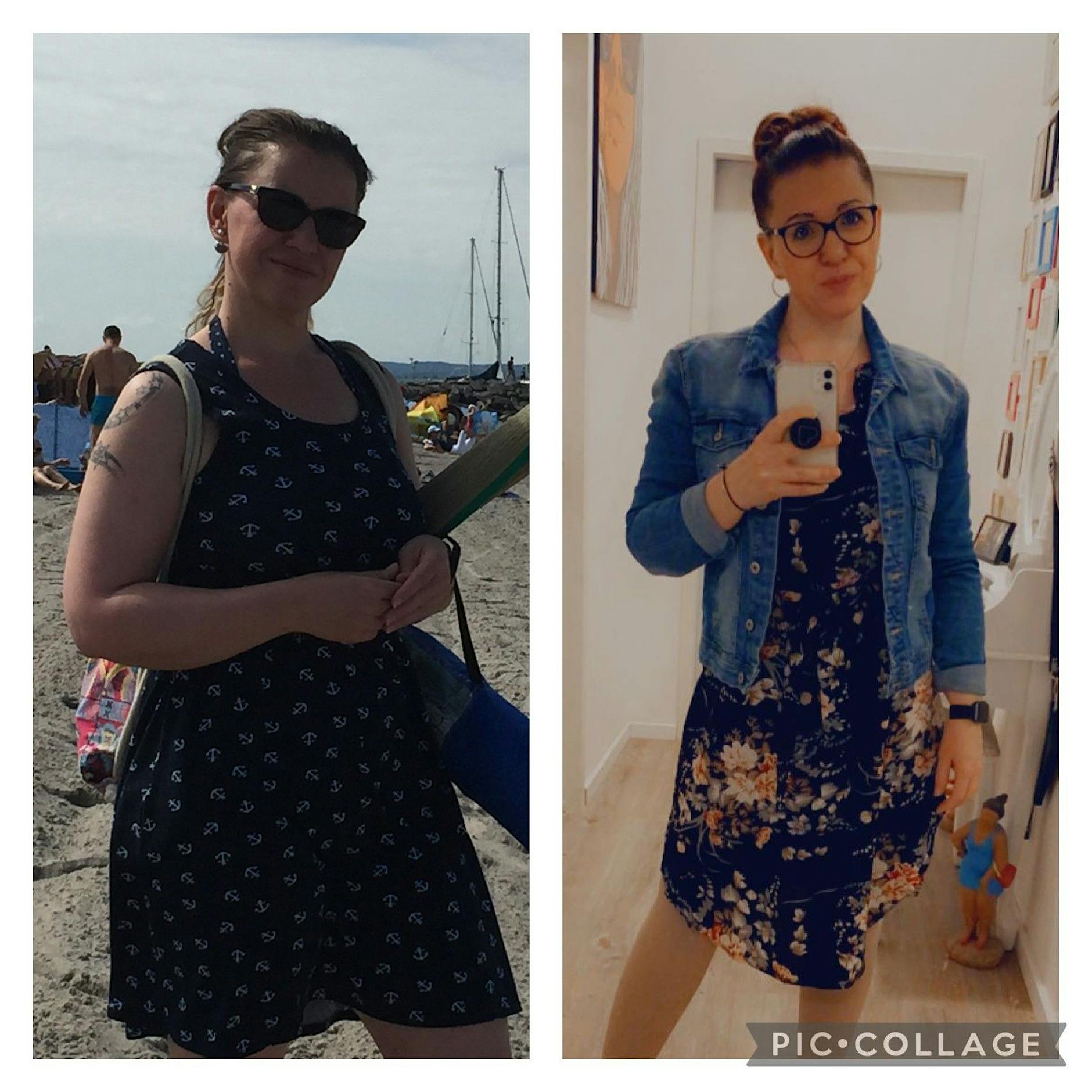 Jana Ferrari (44) teilt das Schicksal von 3,8 Millionen Frauen in Deutschland: „Ich bin auch mit meinem Lipödem eine schöne Frau“