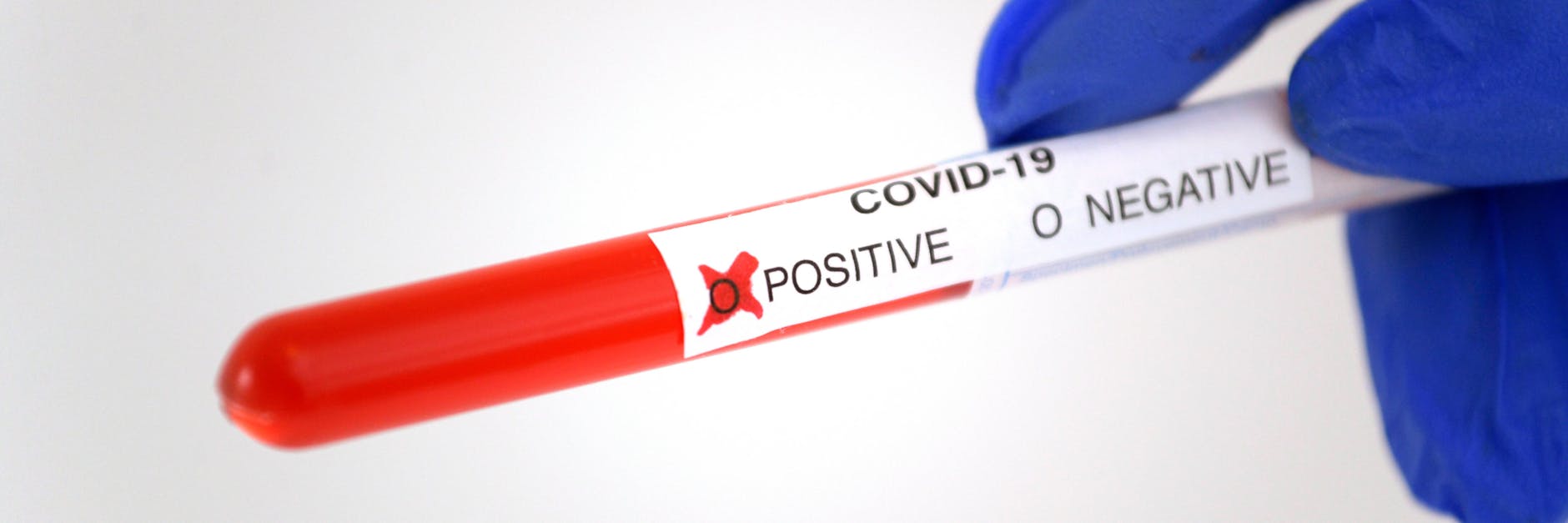 Ein positives Corona-Testergebnis (Symbolfoto)