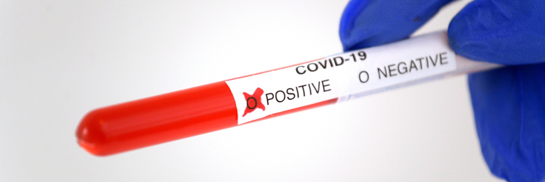 Ein positives Corona-Testergebnis (Symbolfoto)