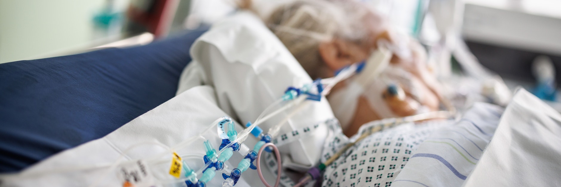 Infusionsschläuche sind am Bett eines intubierten Corona-Patienten in einem Intensivbett-Zimmer angebracht.