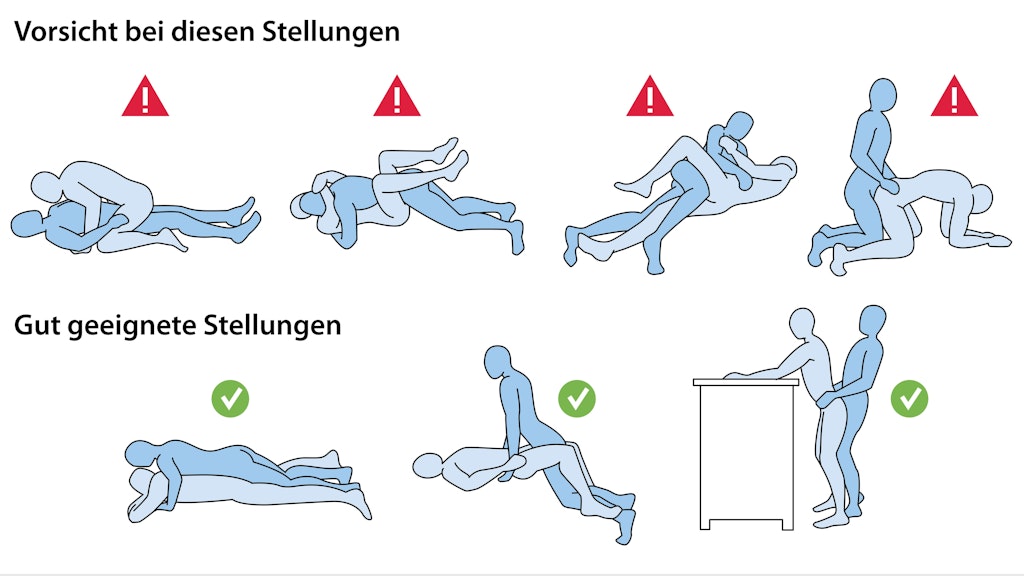 Die Grafik zeigt, welche Sex-Stellungen nach der