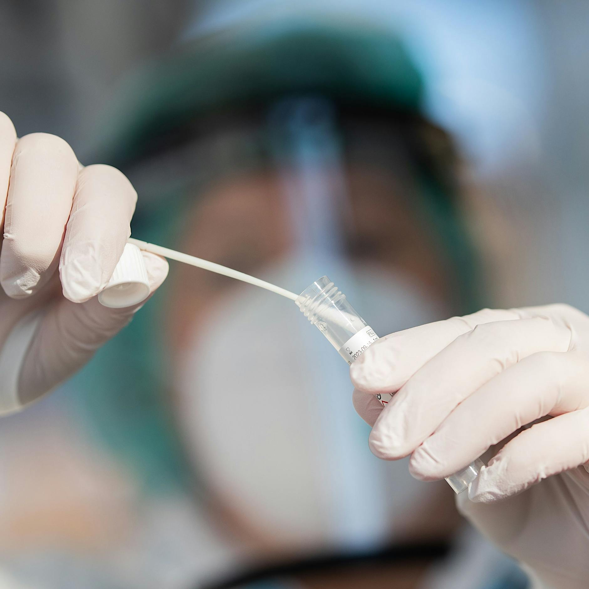 Südafrikas Ärzte: Das sind die Symptome bei einer Omikron-Infektion