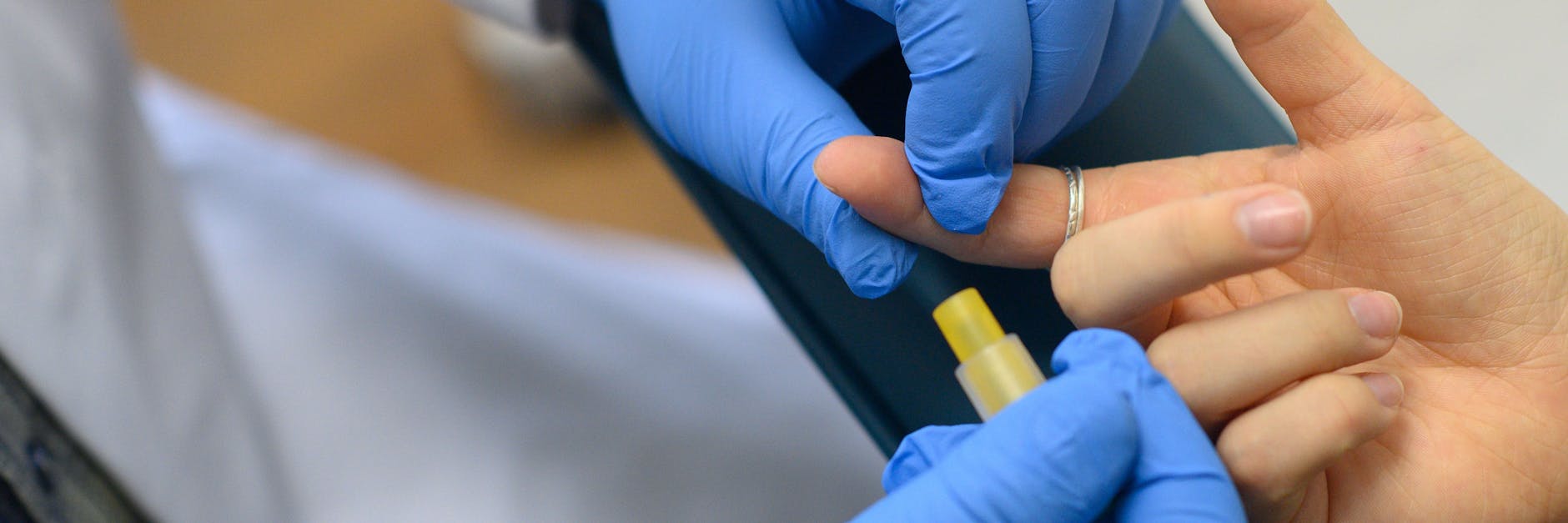  Neuen Zahlen des Robert Koch-Instituts zufolge, sind zuletzt weniger HIV-Ansteckungen registriert worden. 